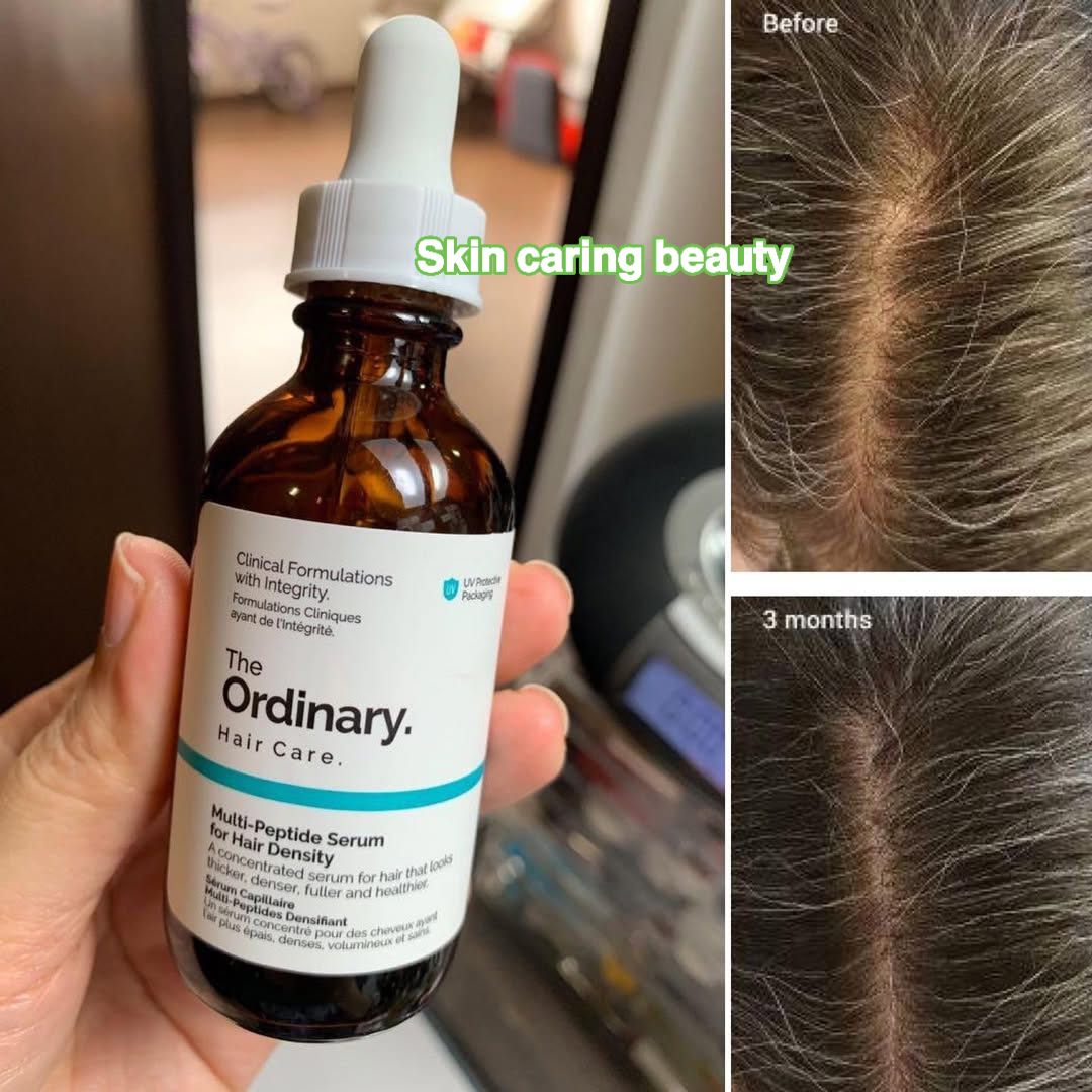 Skin Caring & Beauty Facebook ad: চুল হলো মানুষের সৌন্দর্য।সেই চুল পড়তে পড়তে যদি…