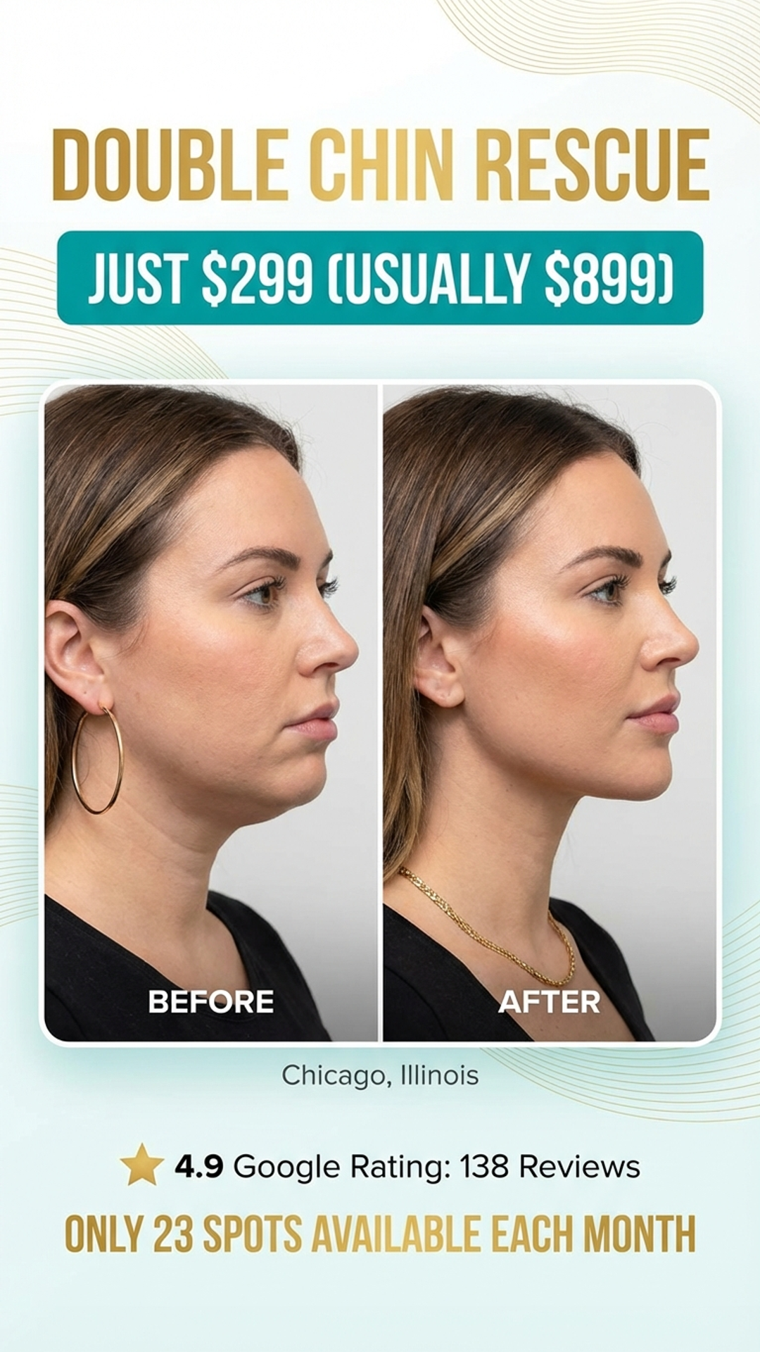 Shaperz Elite Wellness and Aesthetics Facebook ad