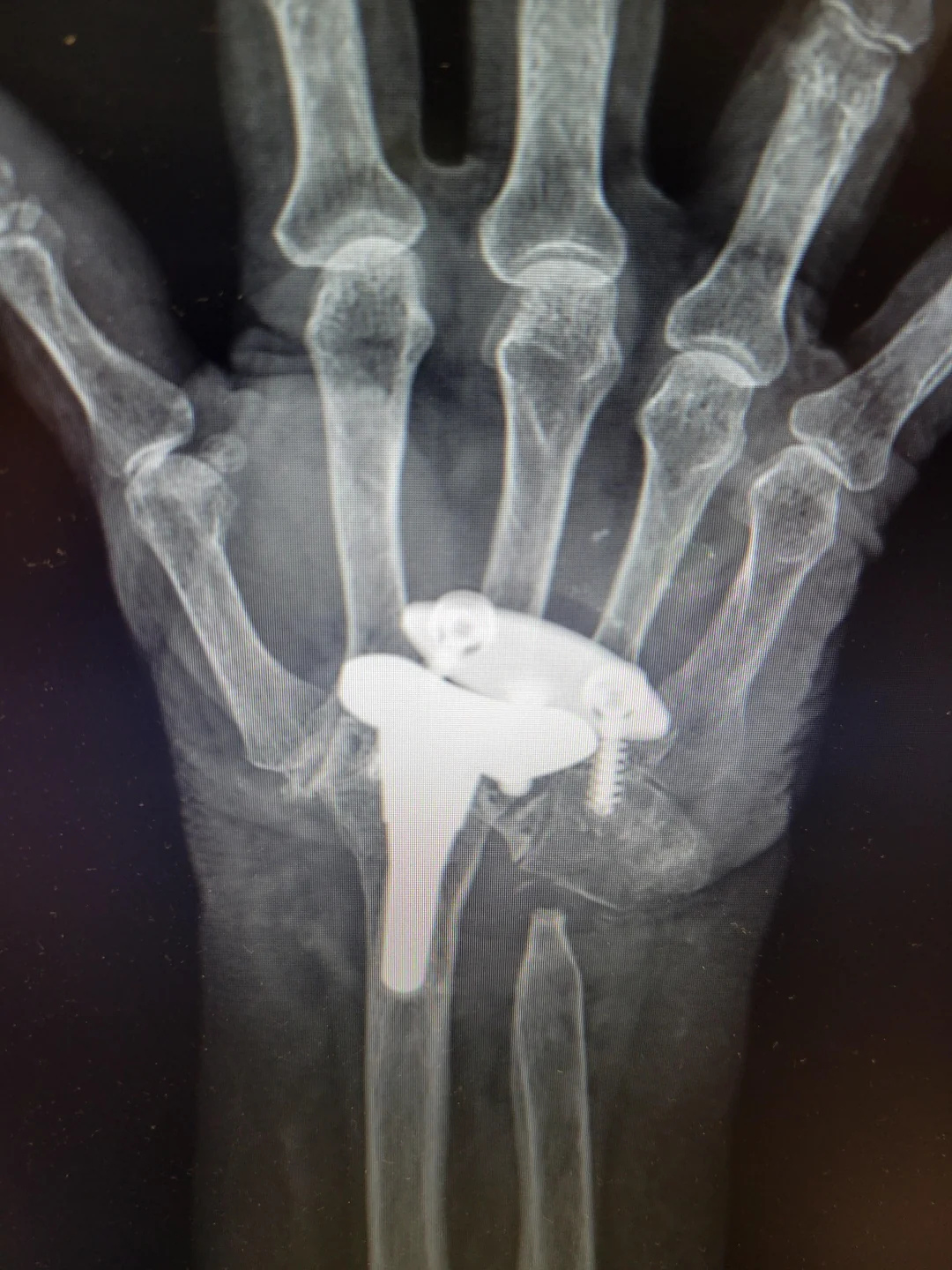 Carpal Tunnel Support Community Facebook ad: Retired Hand Nurse Goes Rogue: This Is the Half of Carpal…