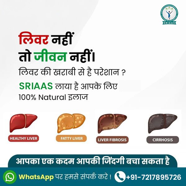 Sriaas Liver Treatment Facebook ad: आज ही संपर्क करे