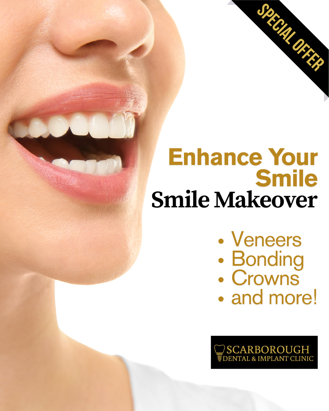 Scarborough Dental & Implant Clinic Facebook ad: Smile Makeover Deals