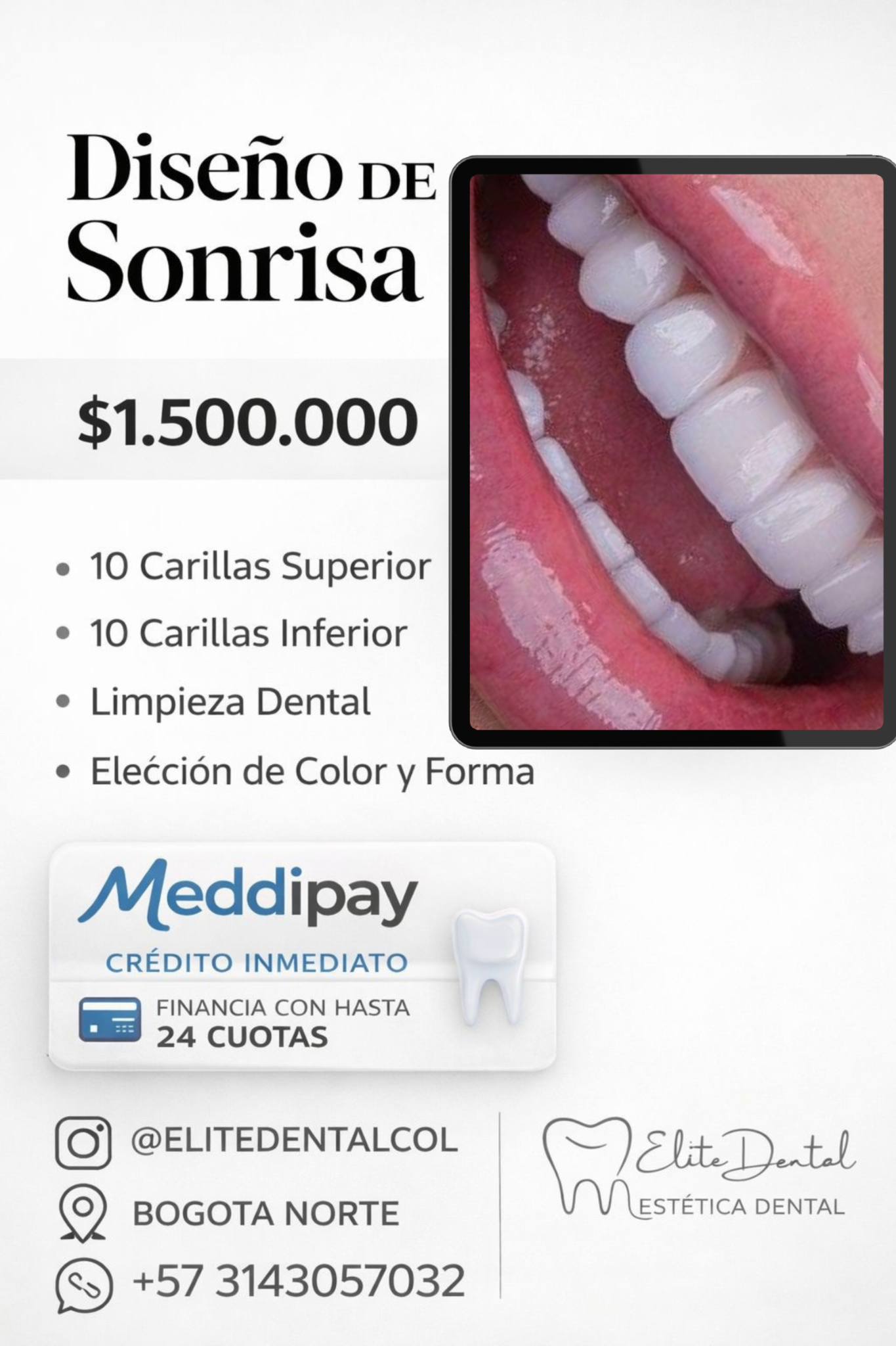 Diseño de sonrisa ed Facebook ad: FINANCIA TU DISEÑO DE SONRISA