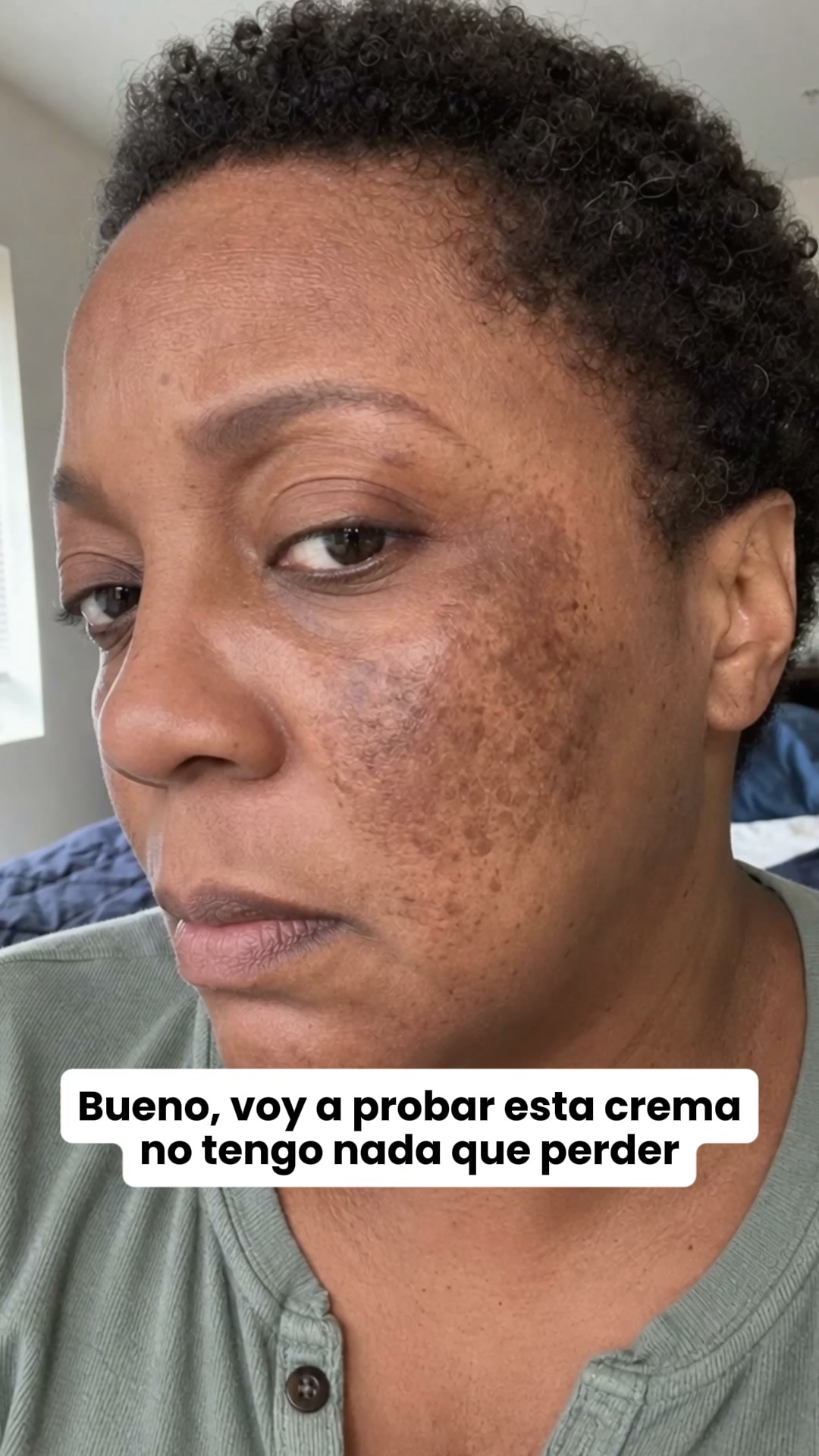 Femyverse Facebook ad: ¿Te han dicho que las manchas no tienen solución?