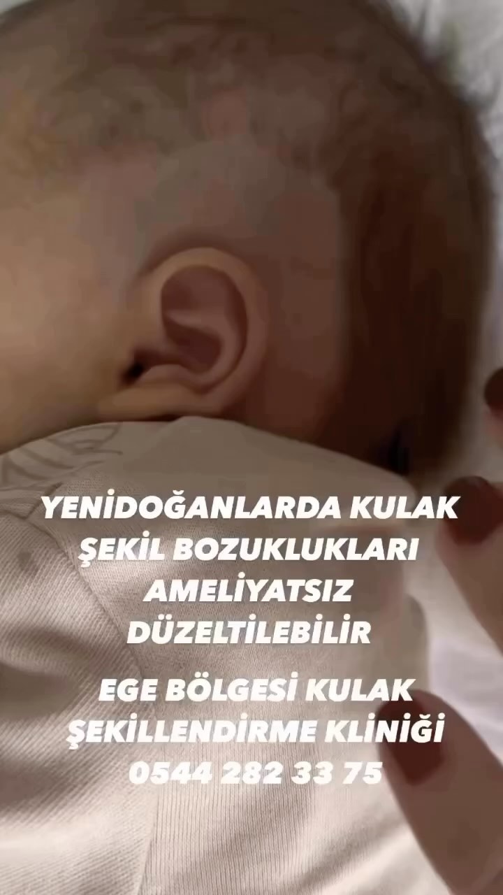 İzmir kulak şekillendirme Facebook ad: YENİDOĞAN BEBEKLERİNİZDE DOĞUŞTAN GELEN KULAK ŞEKİL…