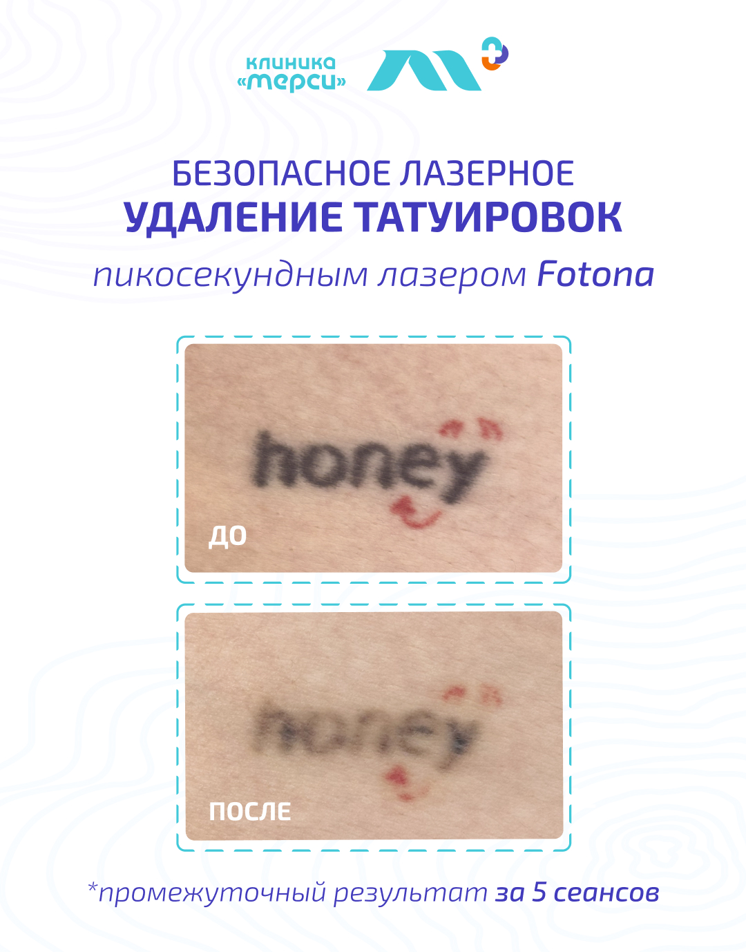 Косметологический центр Клиники «Мерси» Facebook ad from Apr 28, 2026