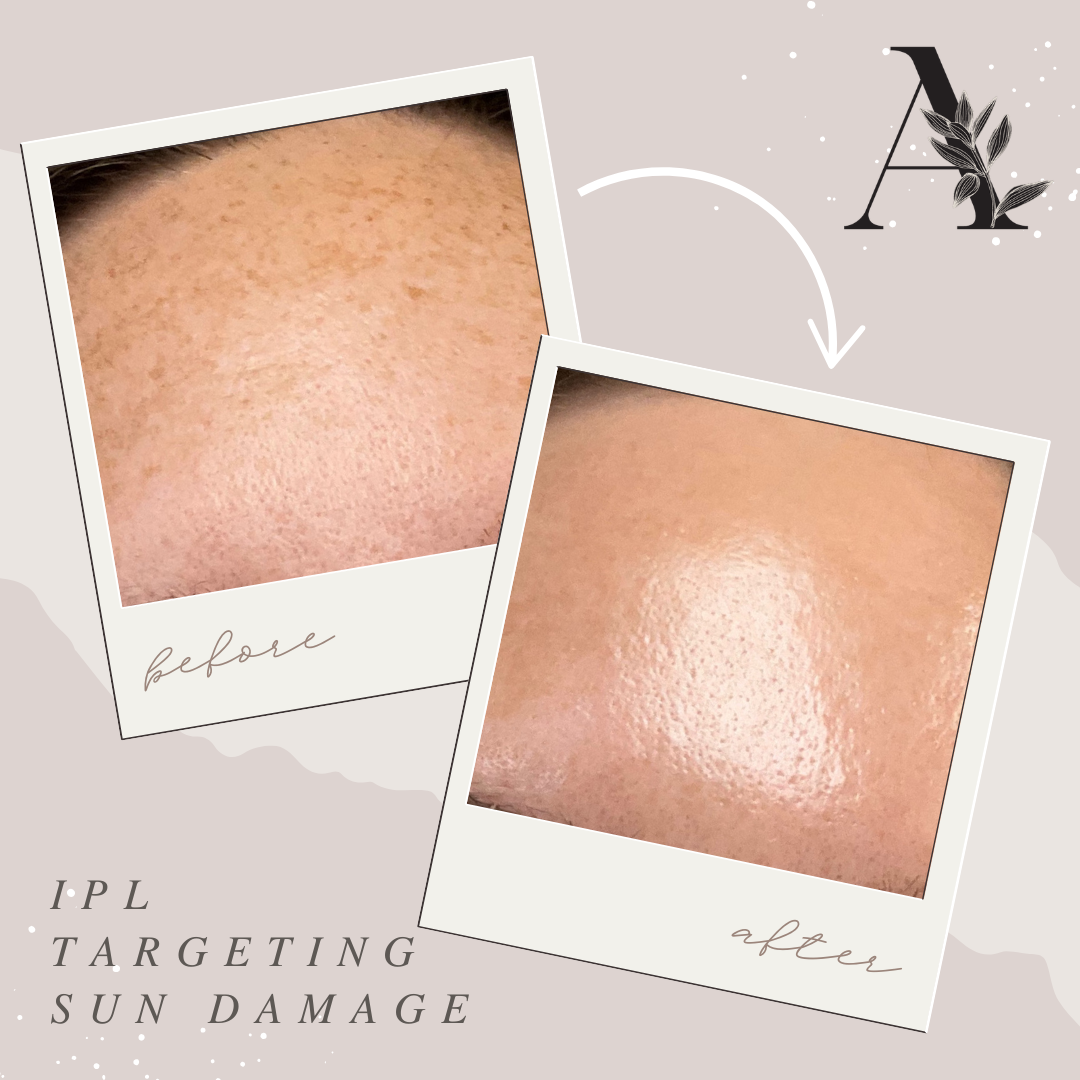 Aesthetix Laser and Med Spa Facebook ad: DM us to start your transformation today!