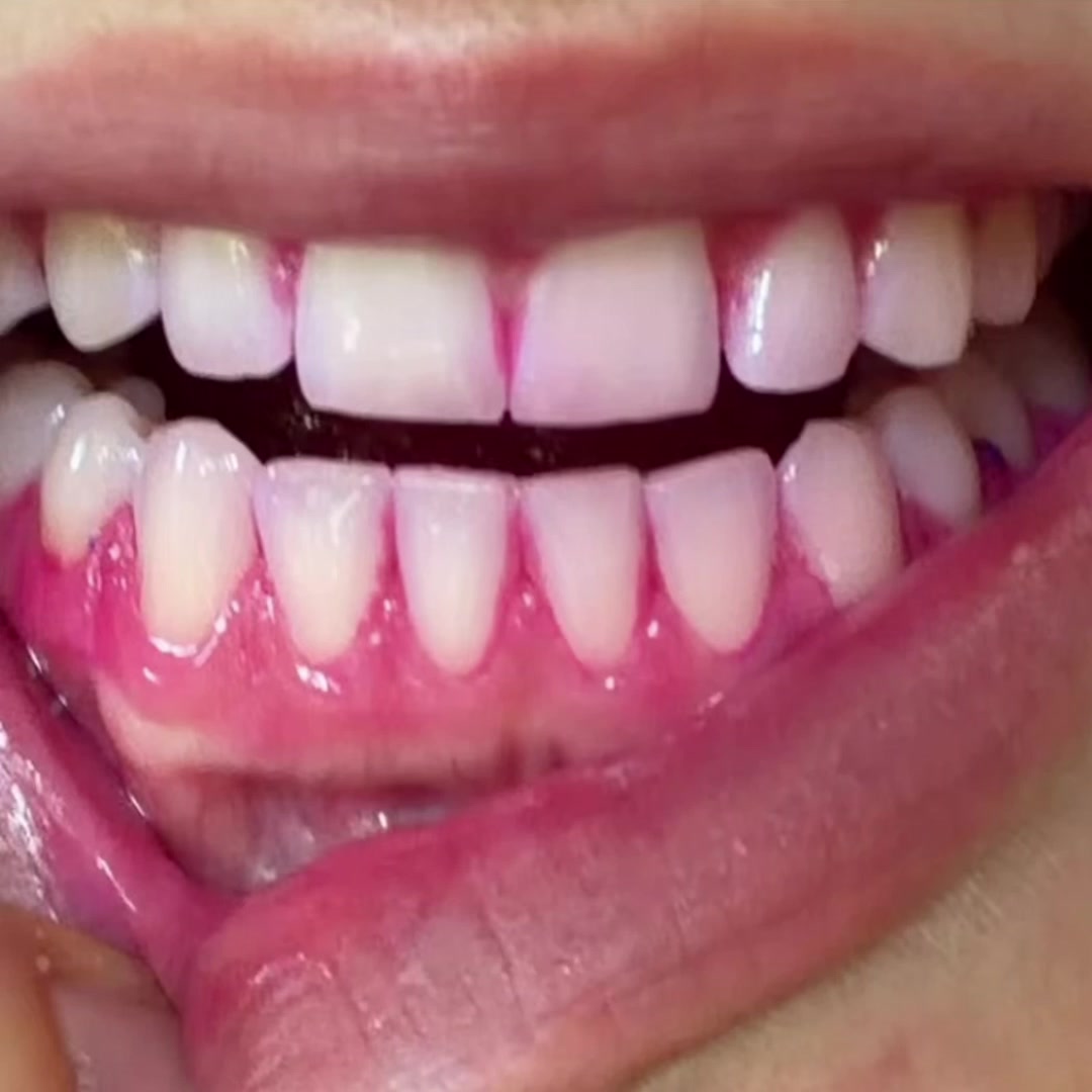 Colgate Australia and New Zealand Facebook ad: Total Active Prevention