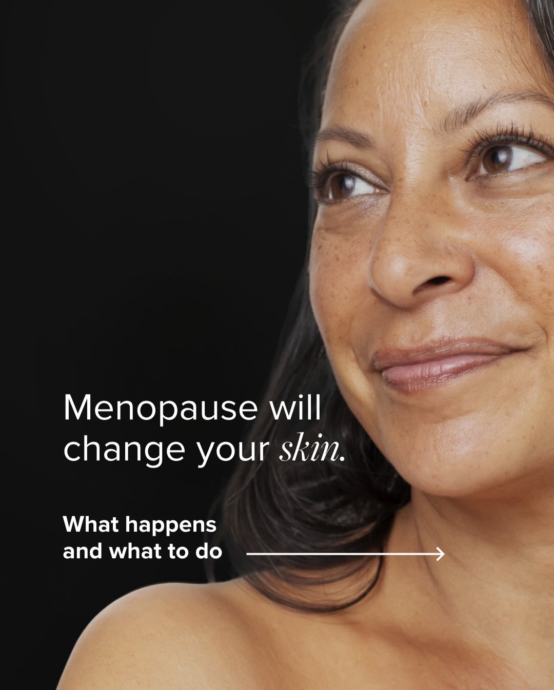 Merz Aesthetics Facebook ad