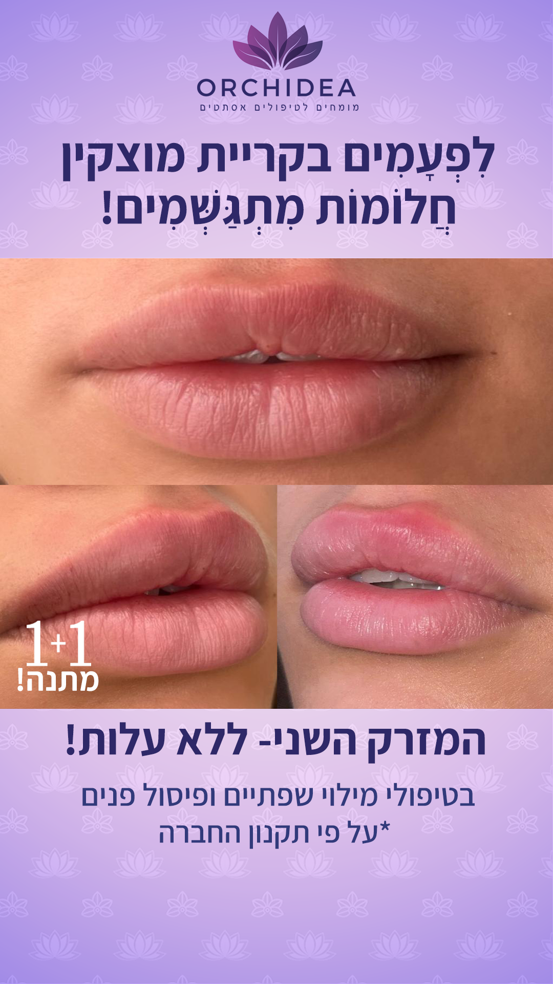 אורכידאה - רשת הקליניקות של המומחים לאסתטיקה רפואית Orchidea Facebook ad