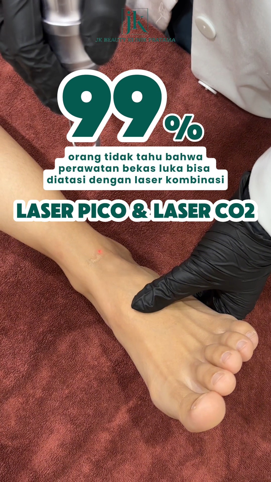 Scarmax - JK Beauty Klinik Pratama Facebook ad: Scarmax, Solusi sempurna untuk keloid