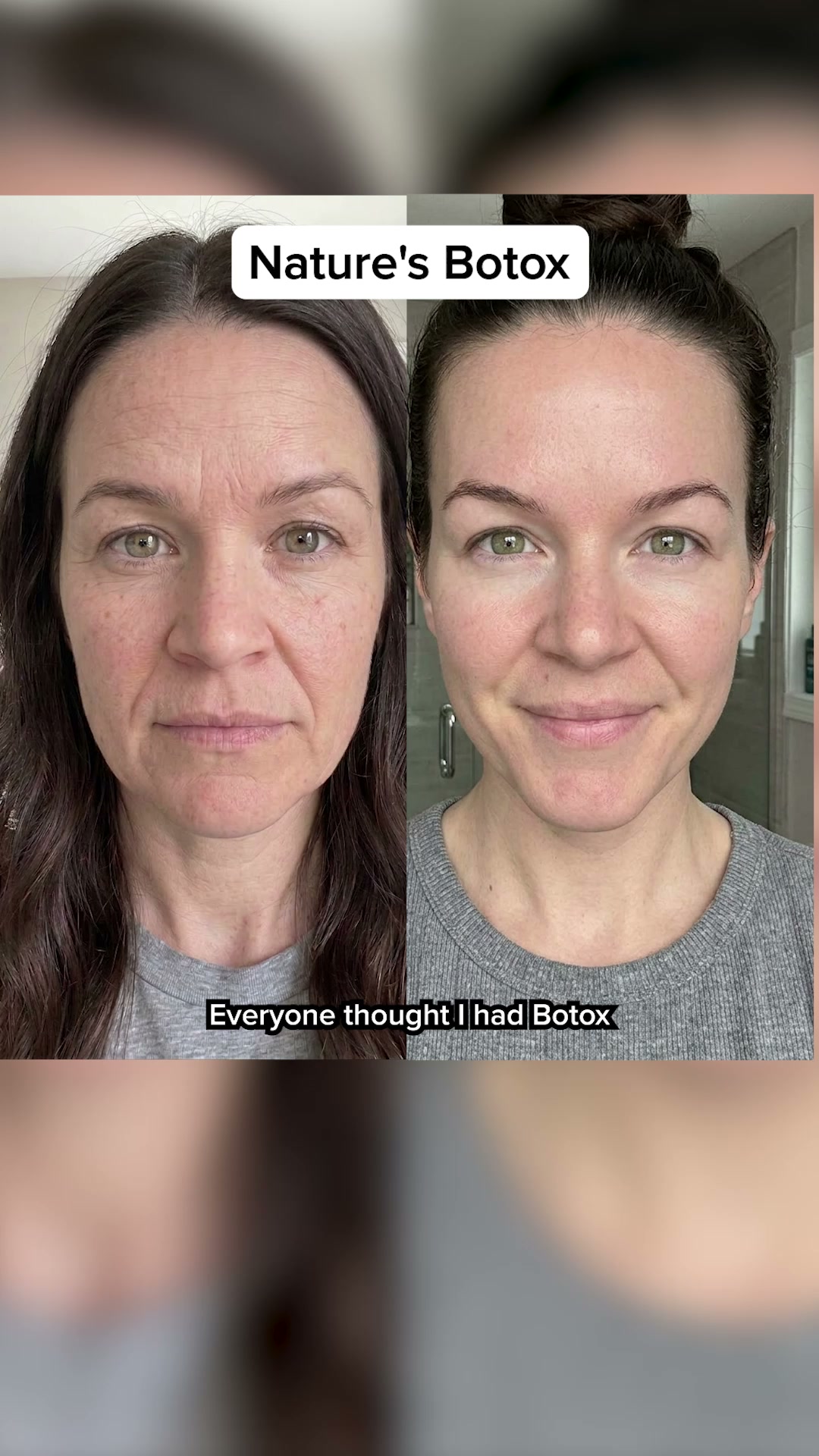 Based Supplies Facebook ad: Restore Your Skin in 3 Weeks!