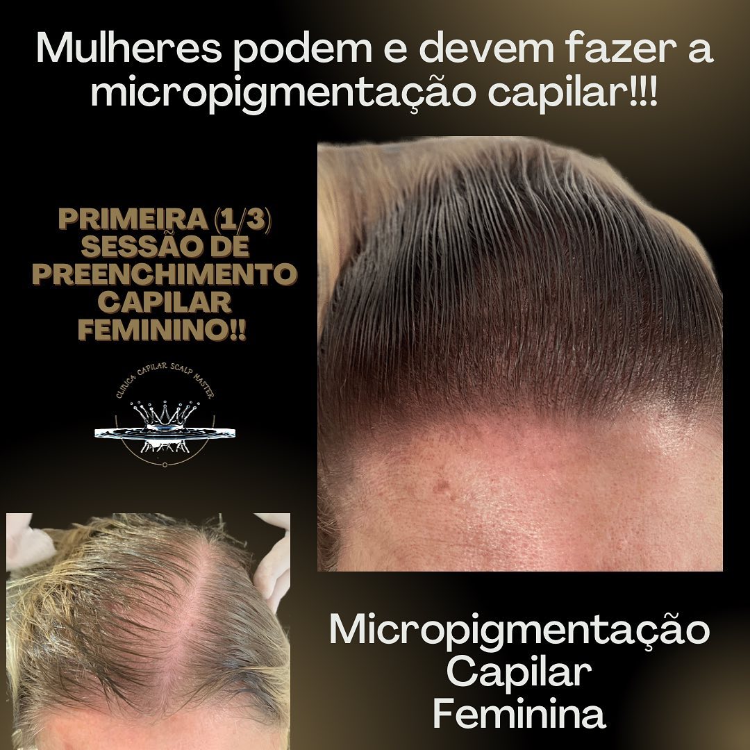 Clinica Capilar Scalp Master Facebook ad