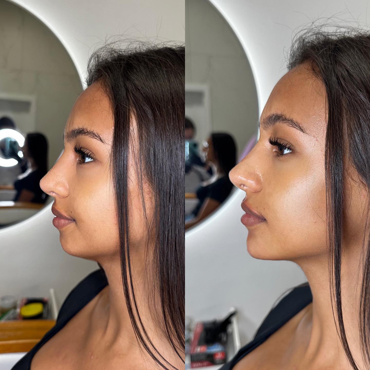 Eleon Clinic Warszawa Facebook ad: Modelowanie brody. Zobaczcie jak 1 zabieg, który trwa…