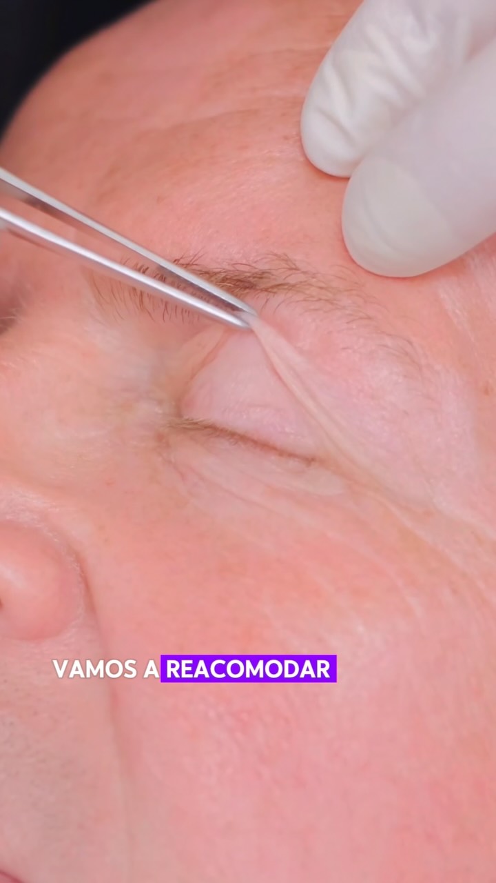Dr. Fernando Rondano Facebook ad: ¿Tu mirada parece cansada aunque hayas dormido bien?