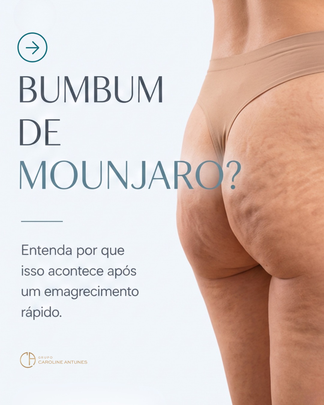Grupo Caroline Antunes Facebook ad: O bumbum Monjauro viralizou nas redes
