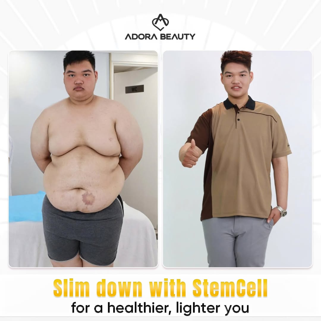 ADORA Beauty - Slimming Aesthetic Center Facebook ad