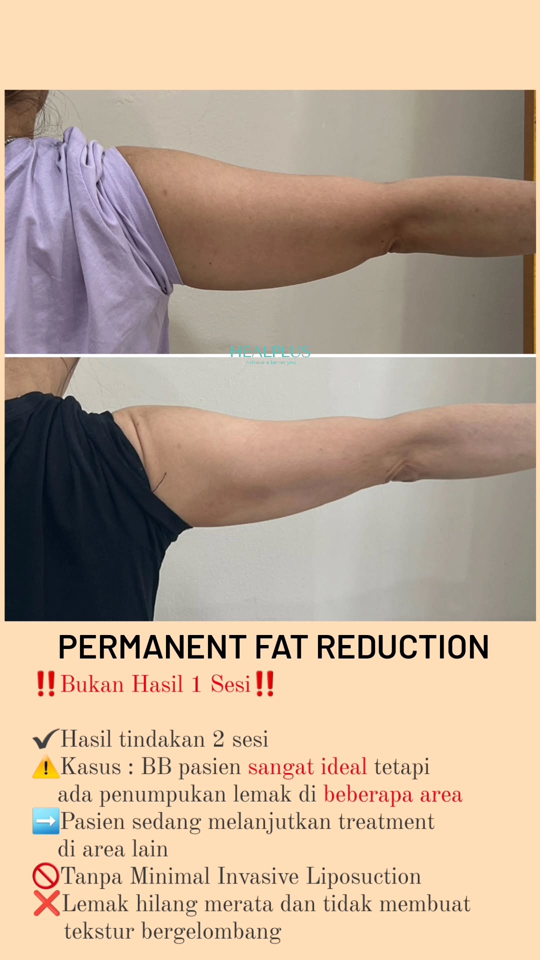 Healplus Homecare Facebook ad from Sep 6, 2025