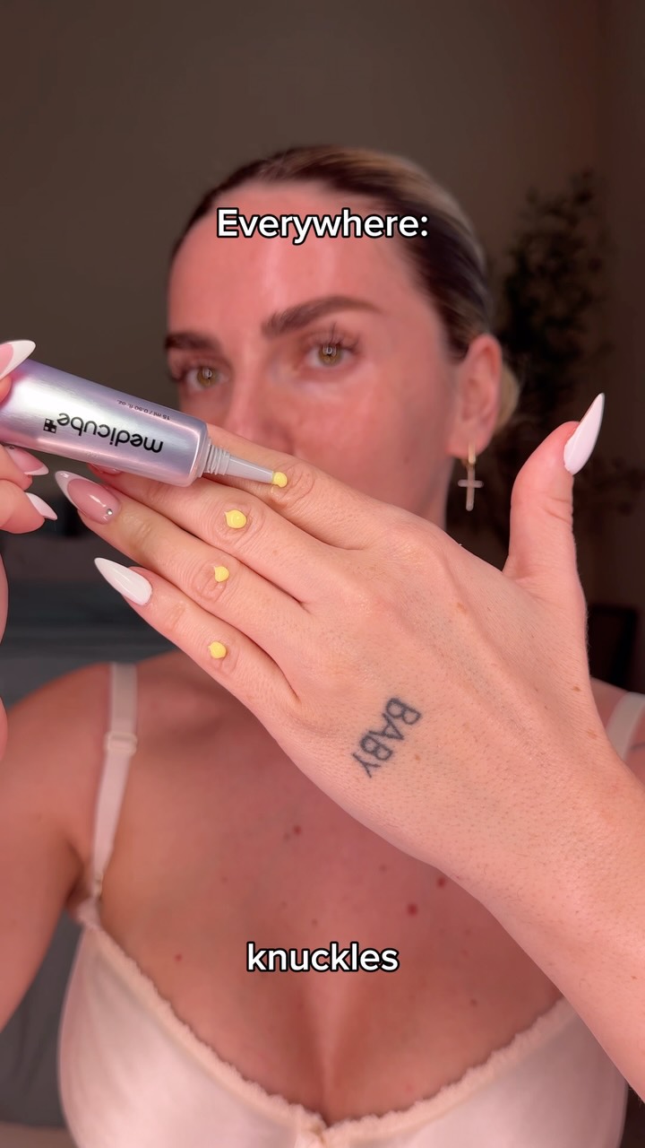 Marimorbeli Facebook ad: STOP using retinal only on your face use…