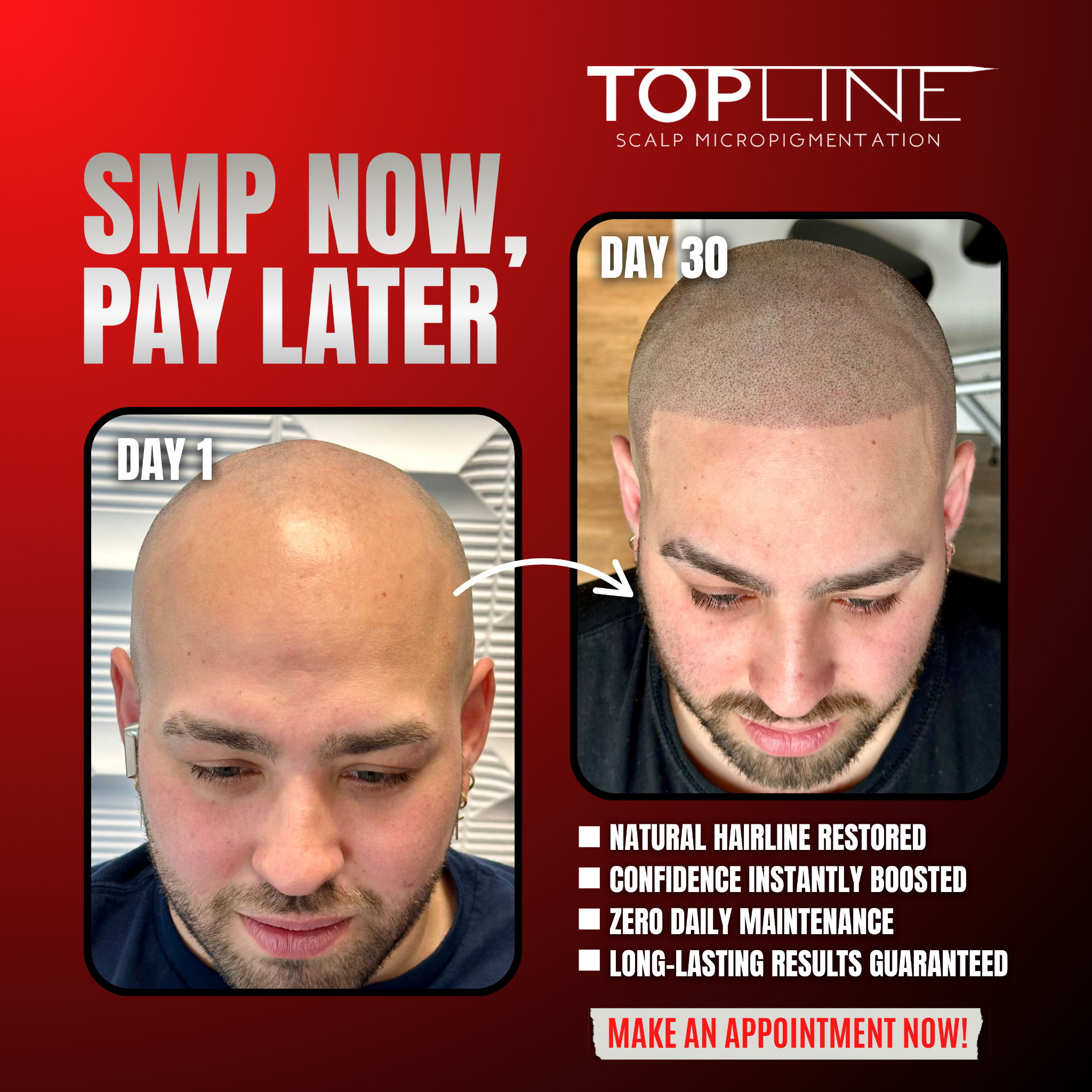 TopLine Scalp MicroPigmentation Facebook ad: 15% OFF SMP, The #1 Hair Loss Fix for Men & Women