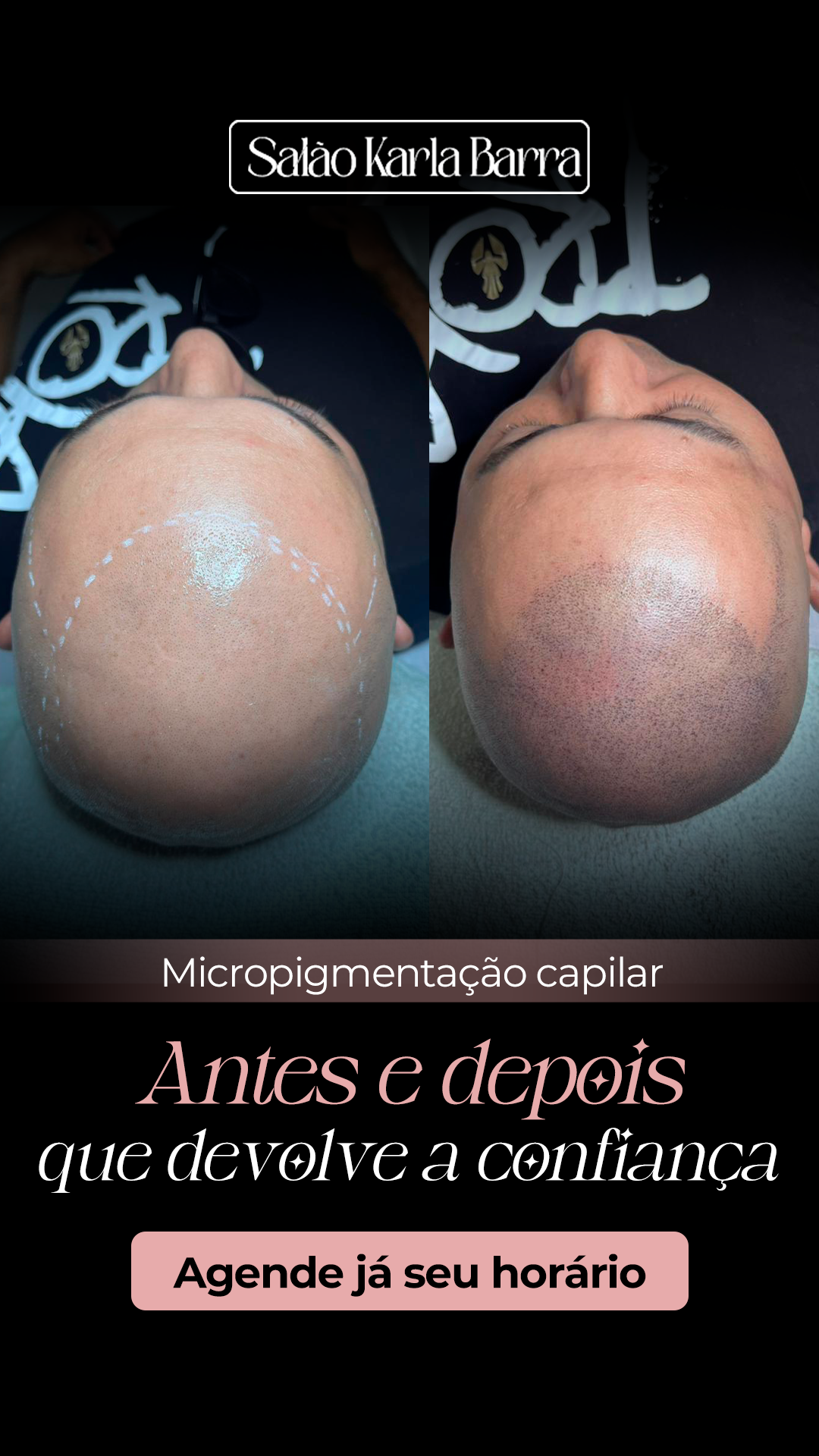 Karla Barra - Fábrica de Loiras Facebook ad from Mar 3, 2026