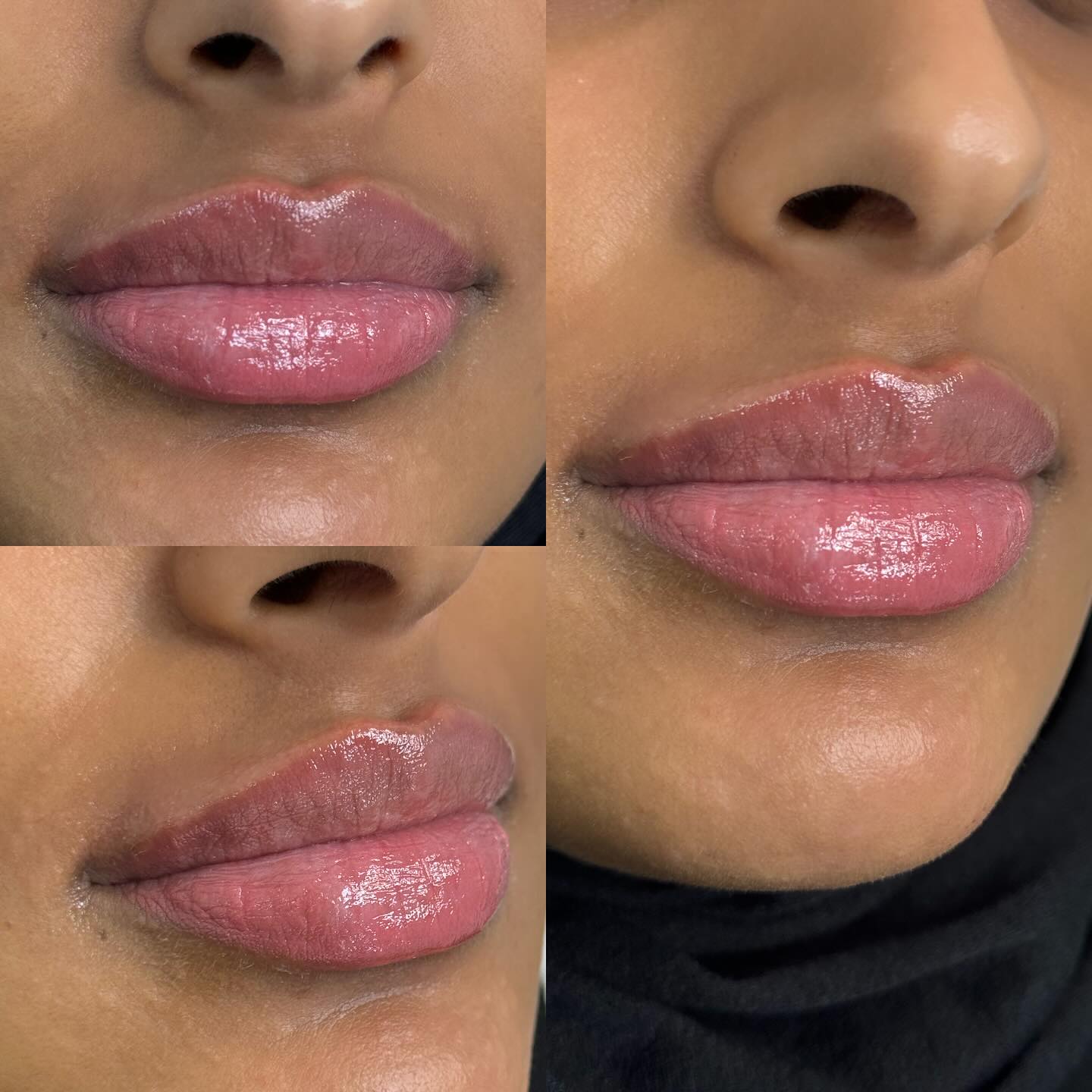 BeautyBar Facebook ad: Lip enhancement ⁣⁣1ml