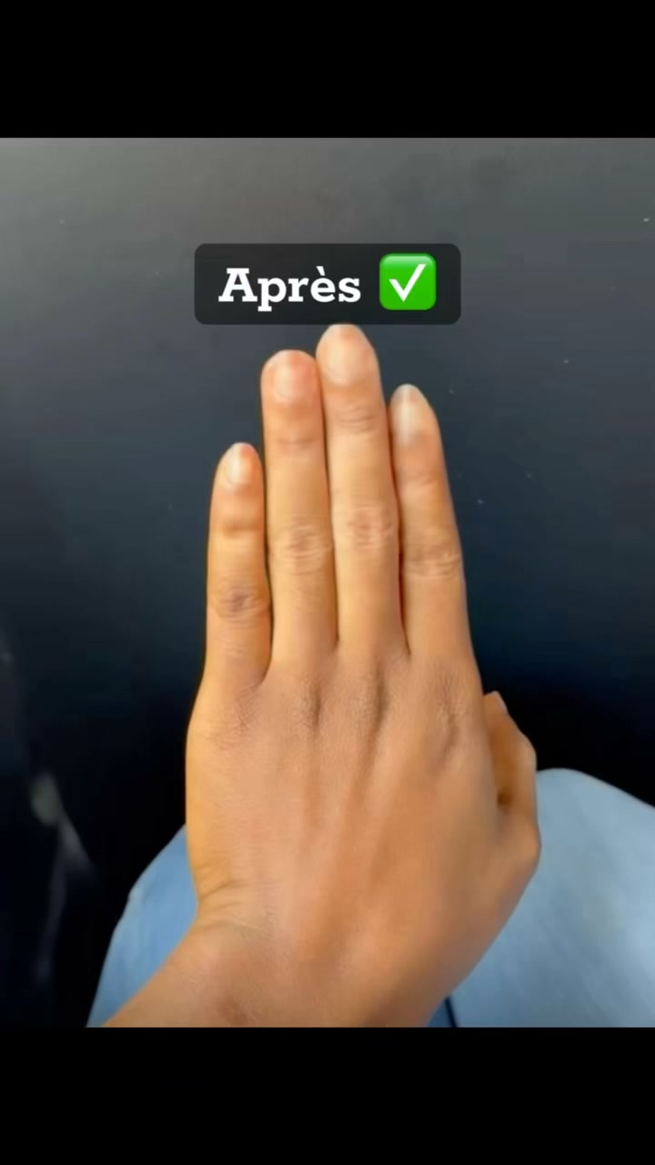 Kisif Mk Facebook ad: Les vergetures, les quintos, les entre-jambes noires ou…
