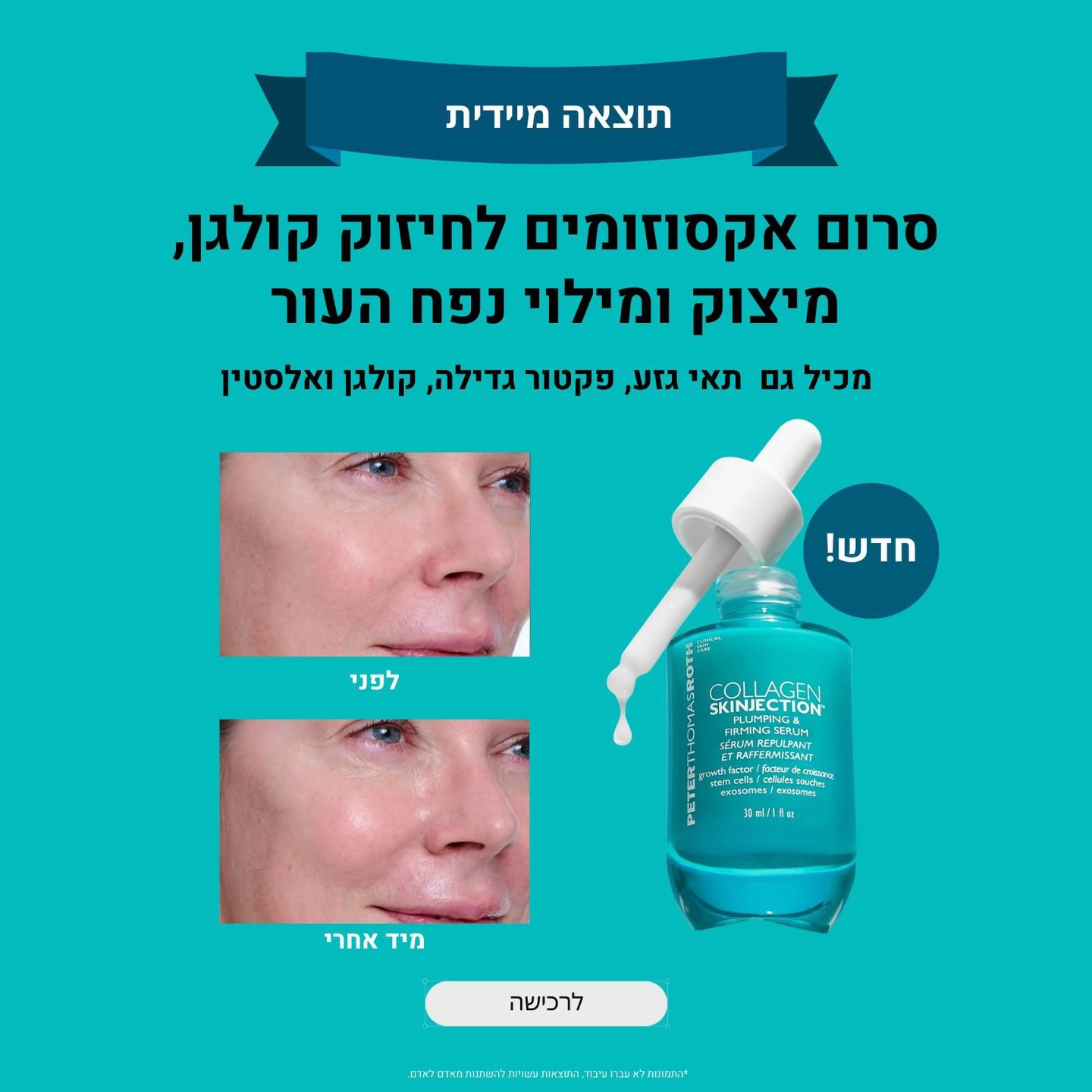 פיטר תומס - Peter Thomas Roth Israel Facebook ad