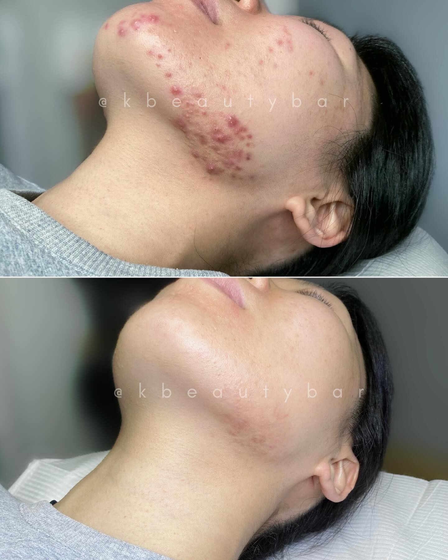 Kbeautybar Facebook ad: This spooky season ghost all your skin concerns!