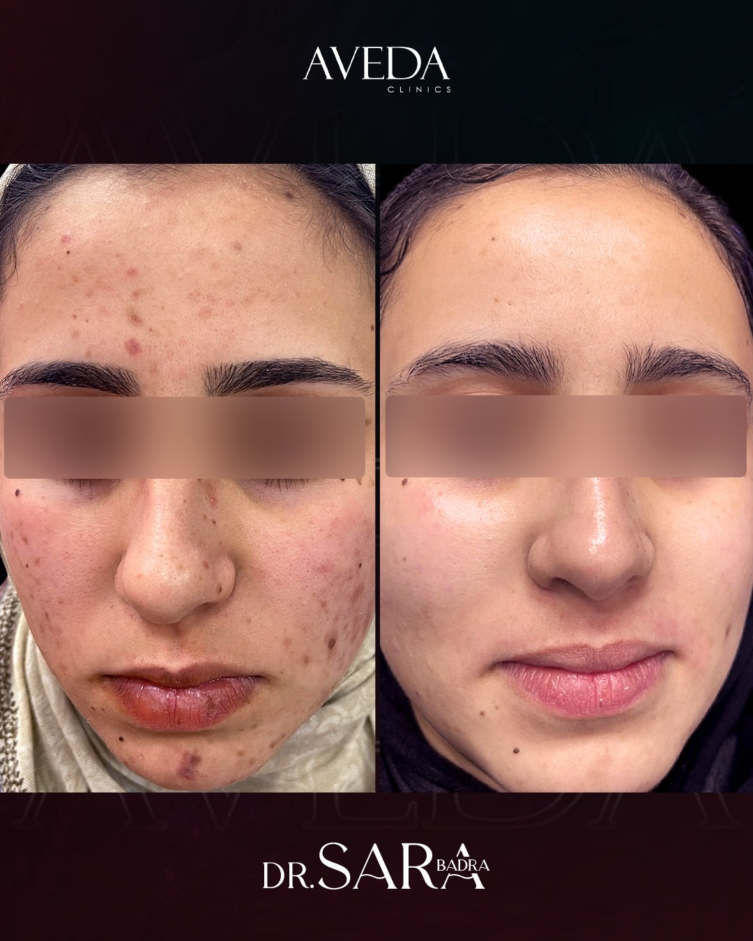 Aveda Clinics Facebook ad