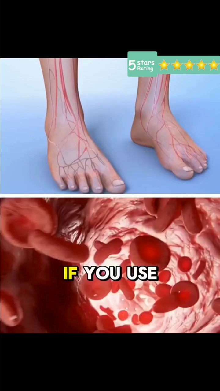 MSN e-store UAE Facebook ad: No Foot, Ankle & Leg Pain