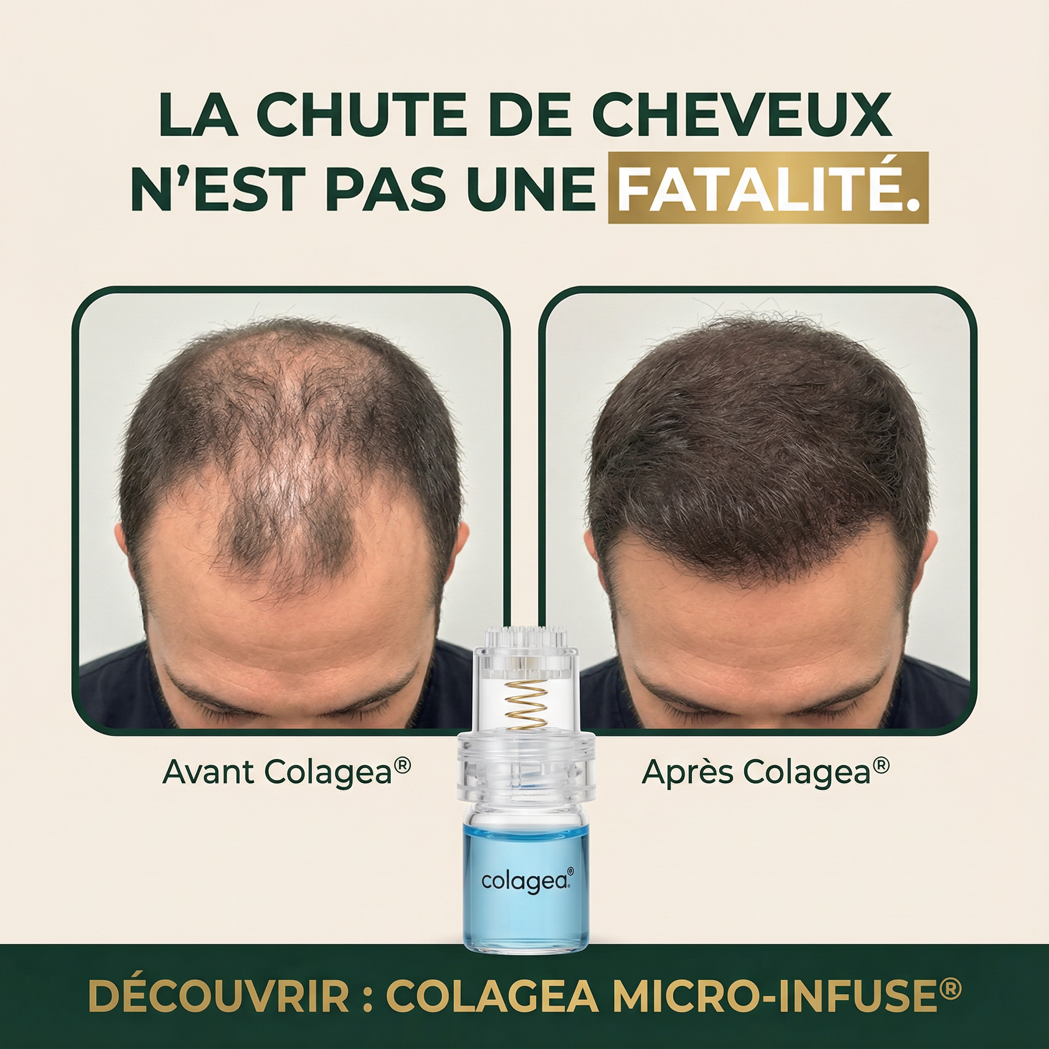 Dr. Victor Delattre Officiel Facebook ad: +7500 Cheveux dès 6 semaines