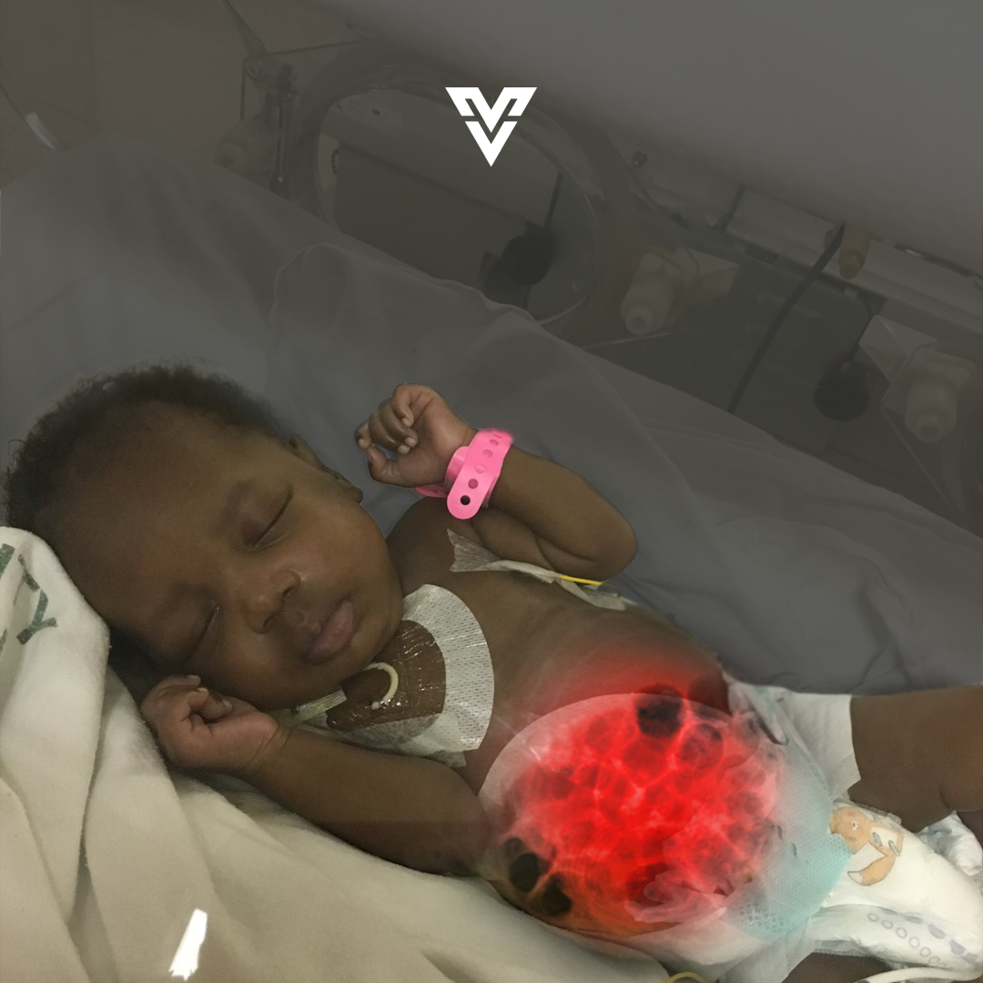 The Flynn Law Firm Facebook ad: Premature Babies w/ NEC Entitled to Compensation
