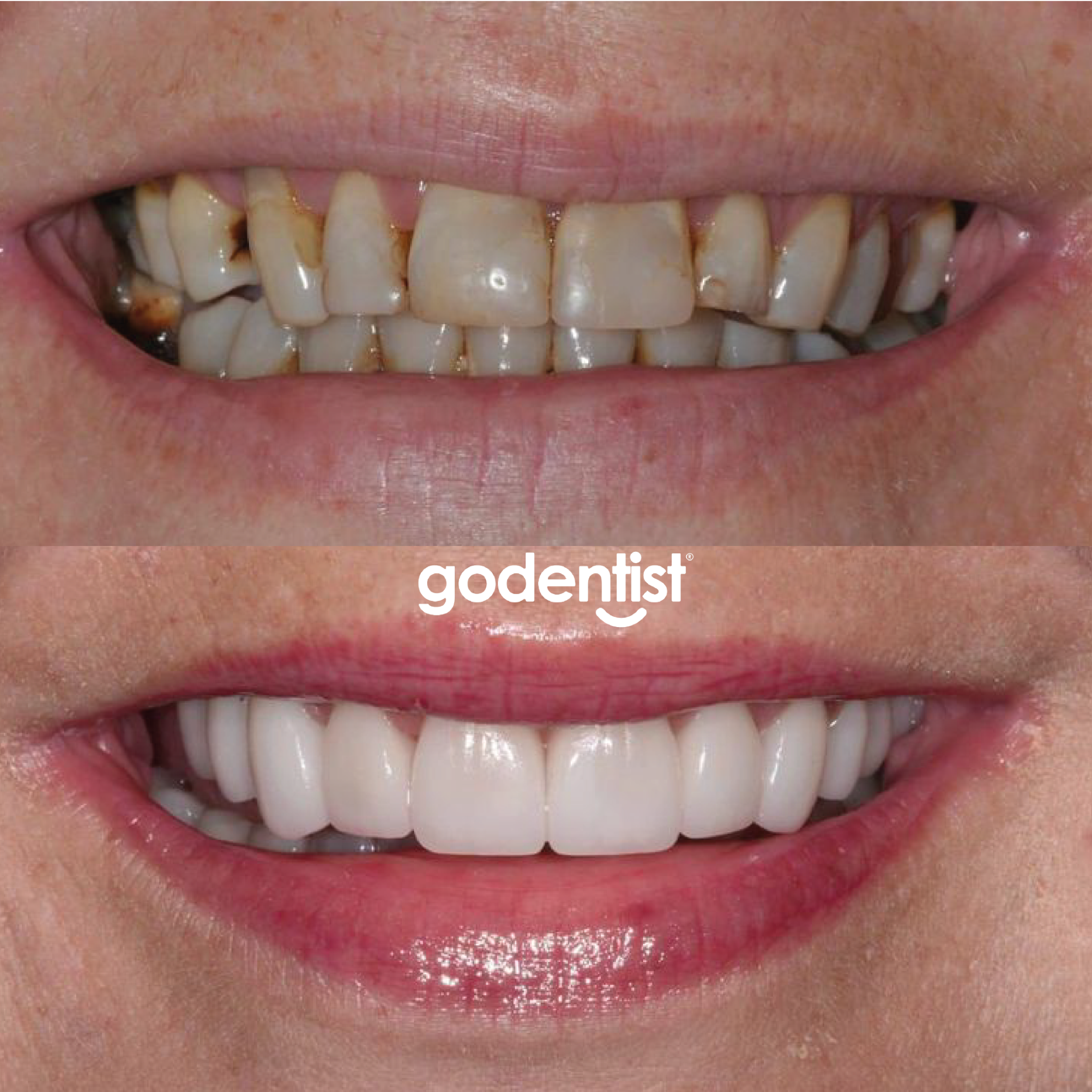 Clínicas Odontológicas Go Dentist Facebook ad