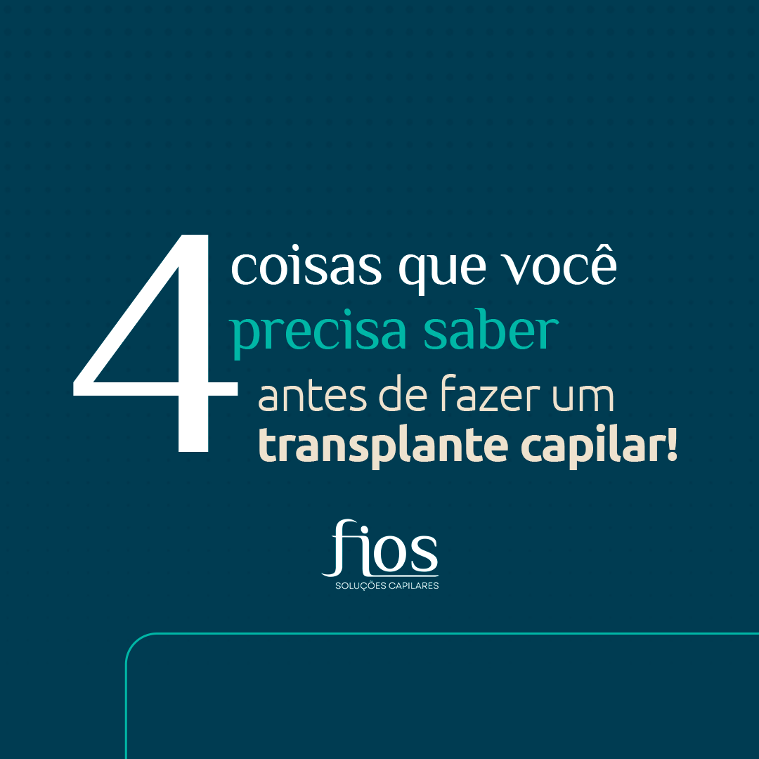 Fios Soluções Capilares Facebook ad: Calvície tem solução!