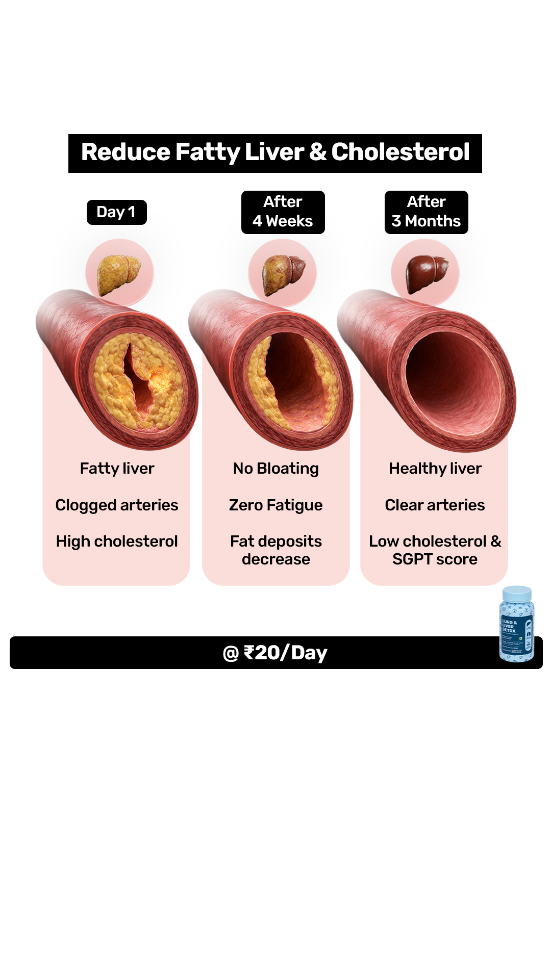 What's Up Wellness Facebook ad: Reduces fatty liver in 90 days
