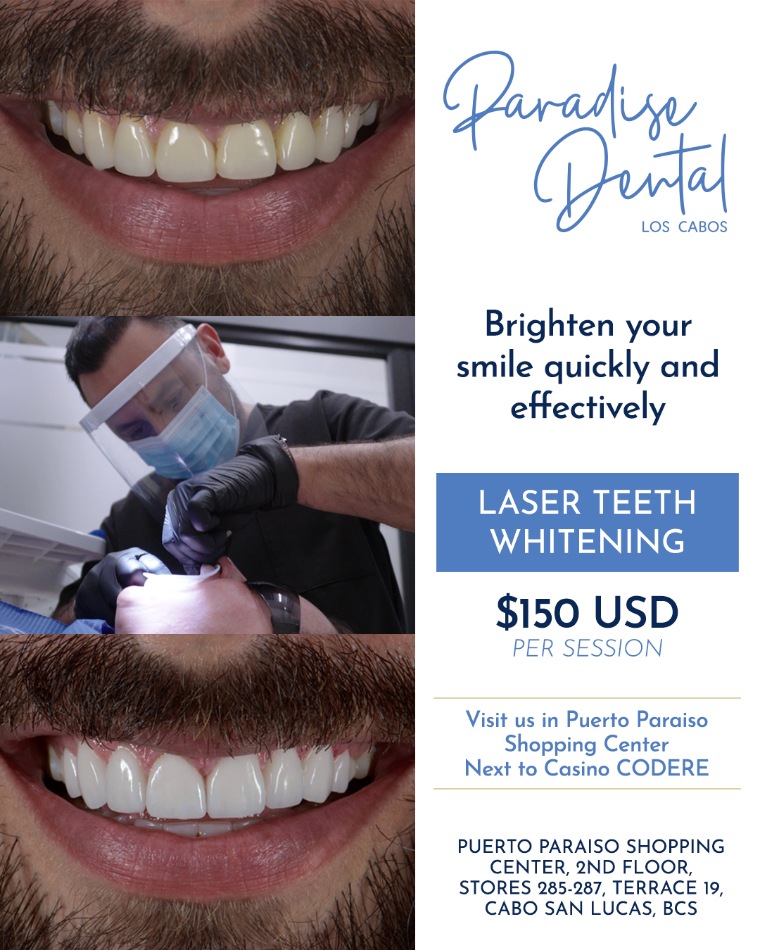 Paradise Dental Los Cabos Facebook ad: Professional teeth whitening in Los Cabos