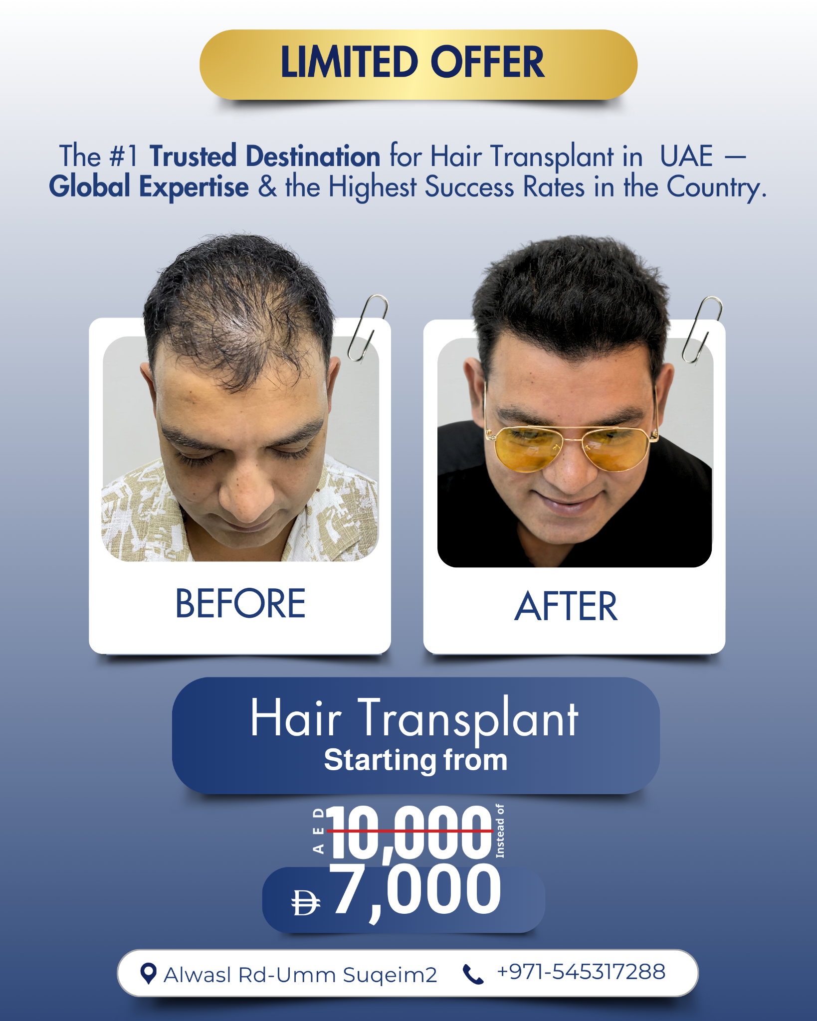 Global Hair Dubai Facebook ad: Chat with us