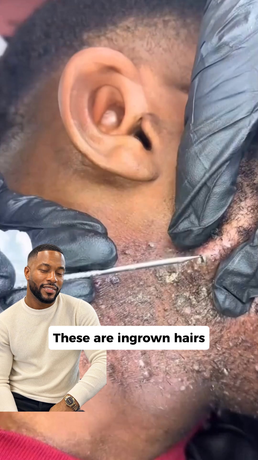 Earthly Derm Facebook ad: Black Men CAN Shave