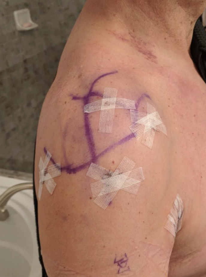 Dr. Abigail Morris Facebook ad: My Shoulder Hurt for 3 Years. 4 BPC-157 Brands Did…