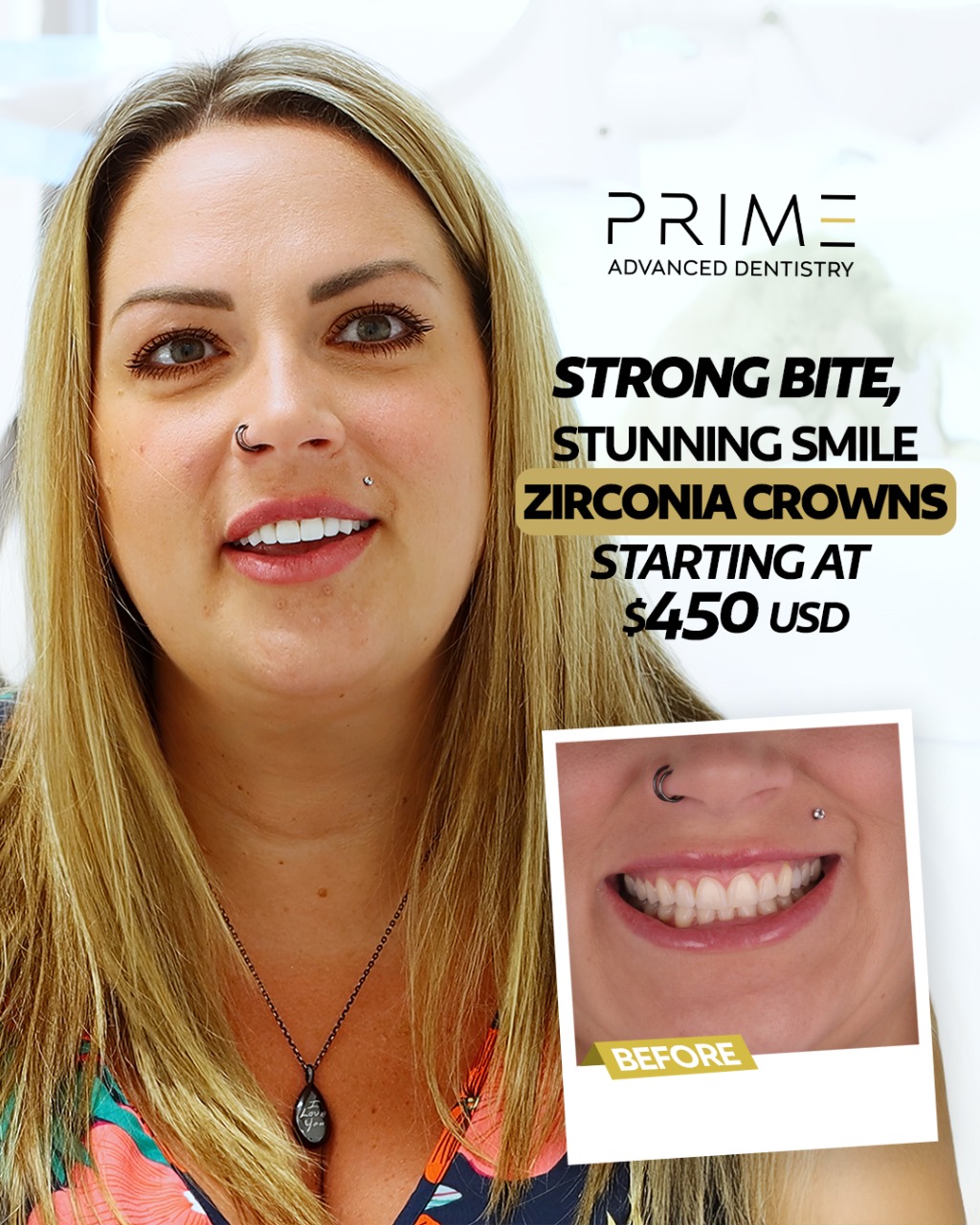 Prime Advanced Dentistry Facebook ad: Upgrade your smile with high-precision crowns From $450 USD.