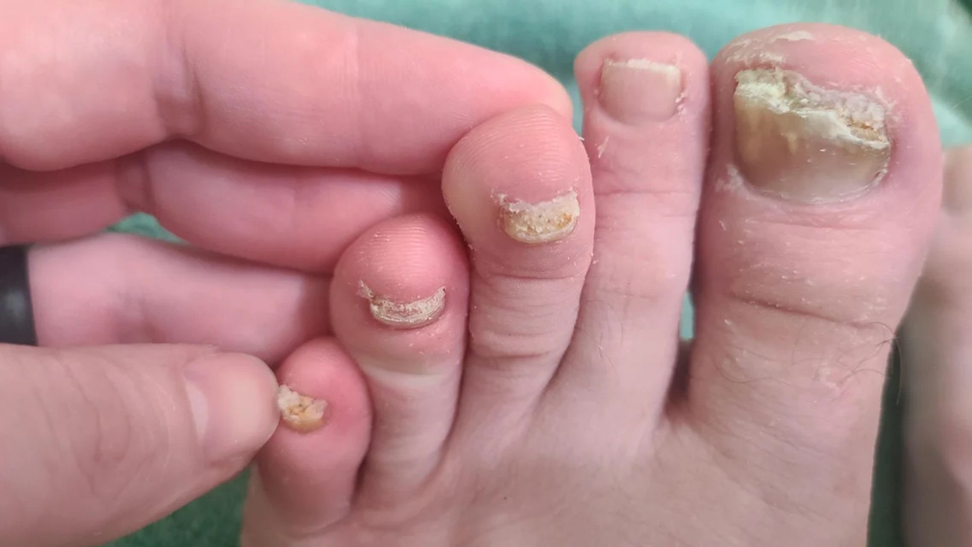 Morgan's Foot Care Diary Facebook ad