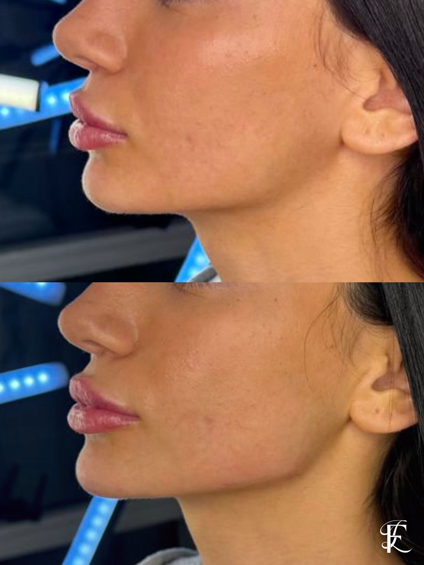 Dr Lautaro Franco Aesthetic Medicine  Facebook ad