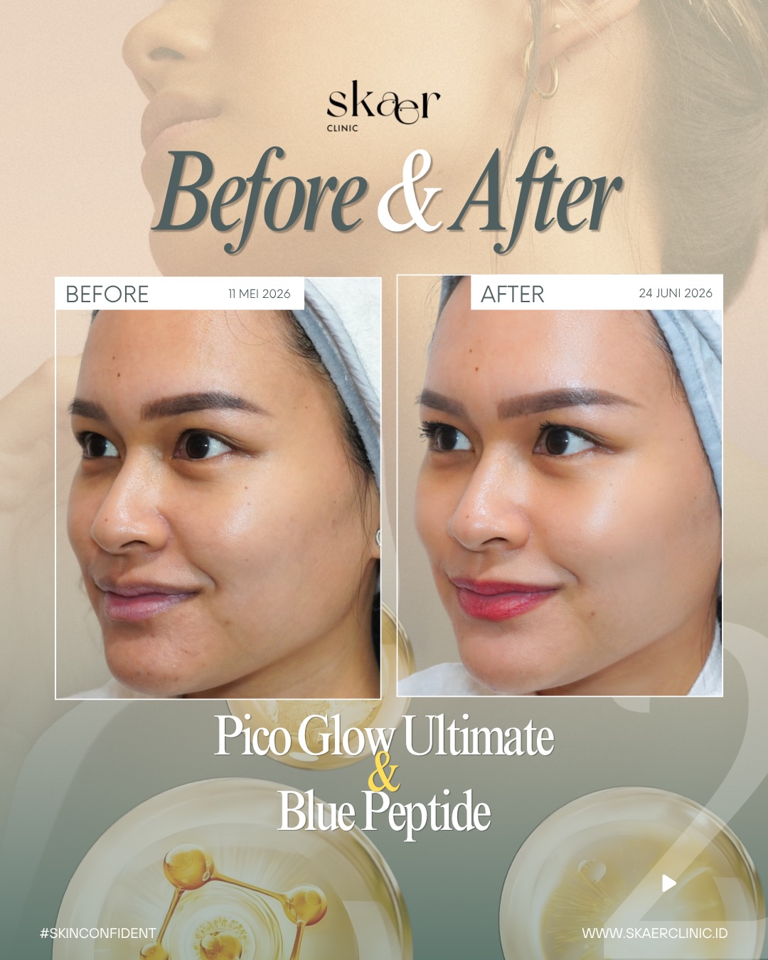 SkaerClinic Facebook ad: Glowing skin starts with healthy skin.