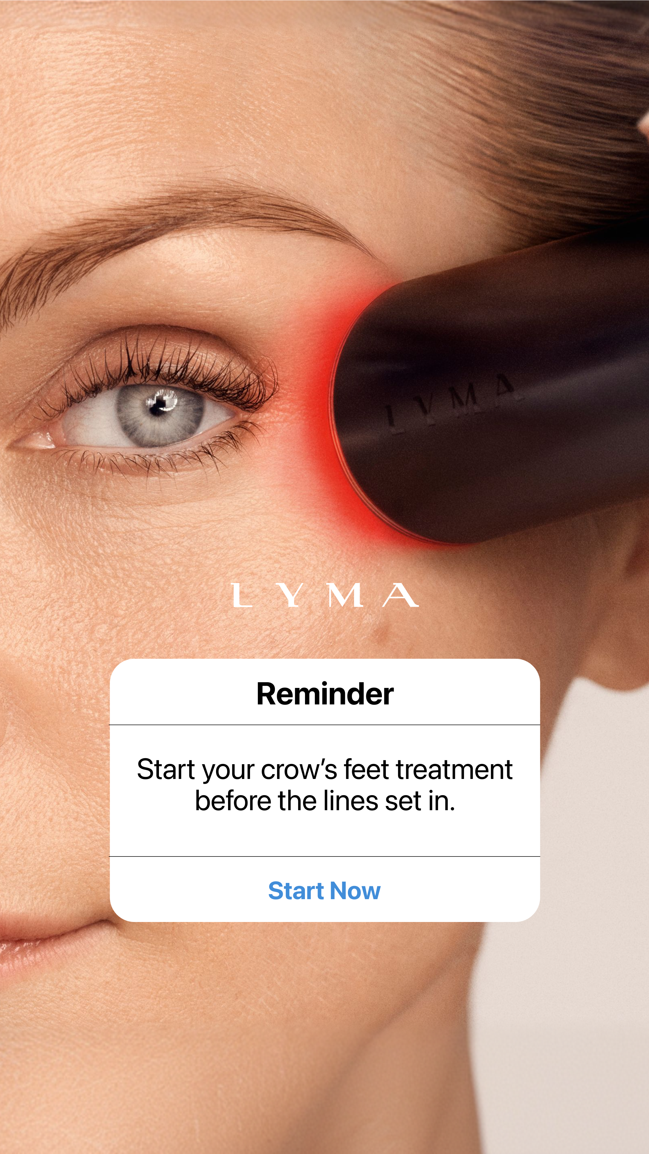 LYMA Facebook ad