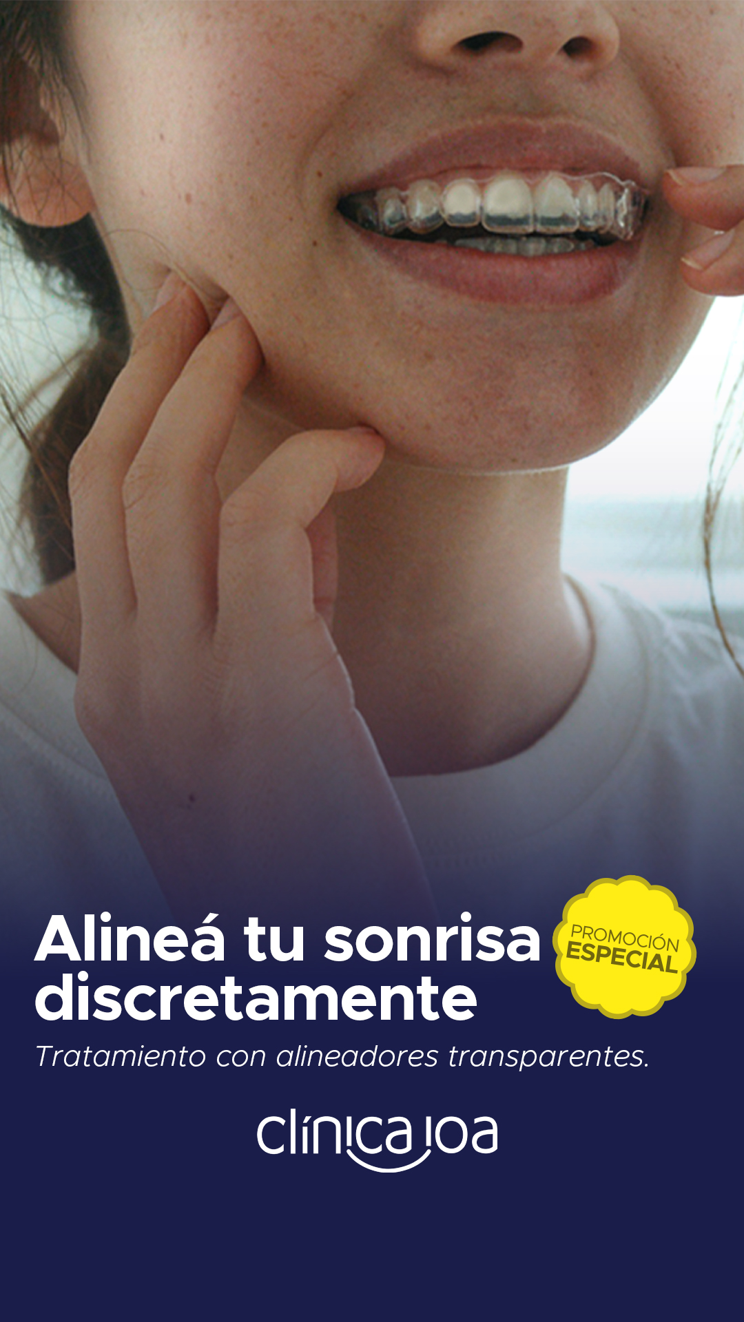 Clínica Odontológica - IOA Facebook ad: ¡Hasta 20% OFF en alineadores!