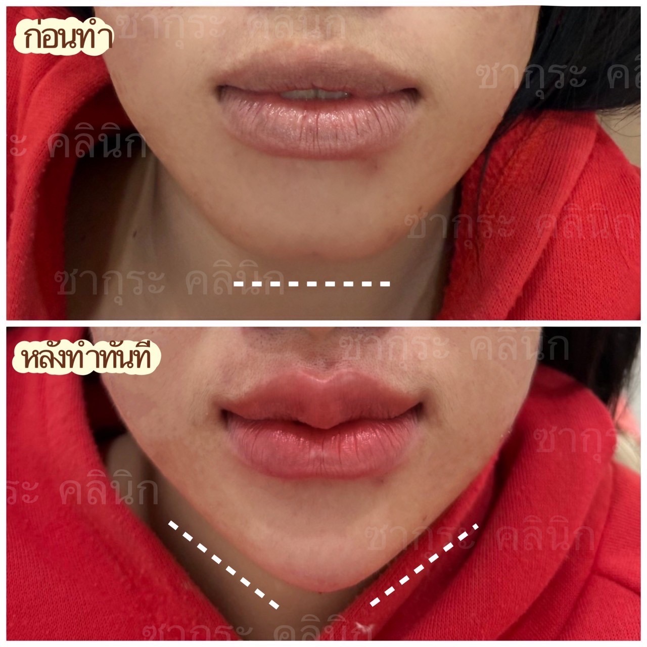 ซากุระคลินิก นางรอง Facebook ad