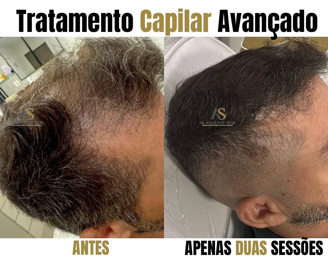 Dr Adailson Silva Facebook ad: Fortaleza - CE