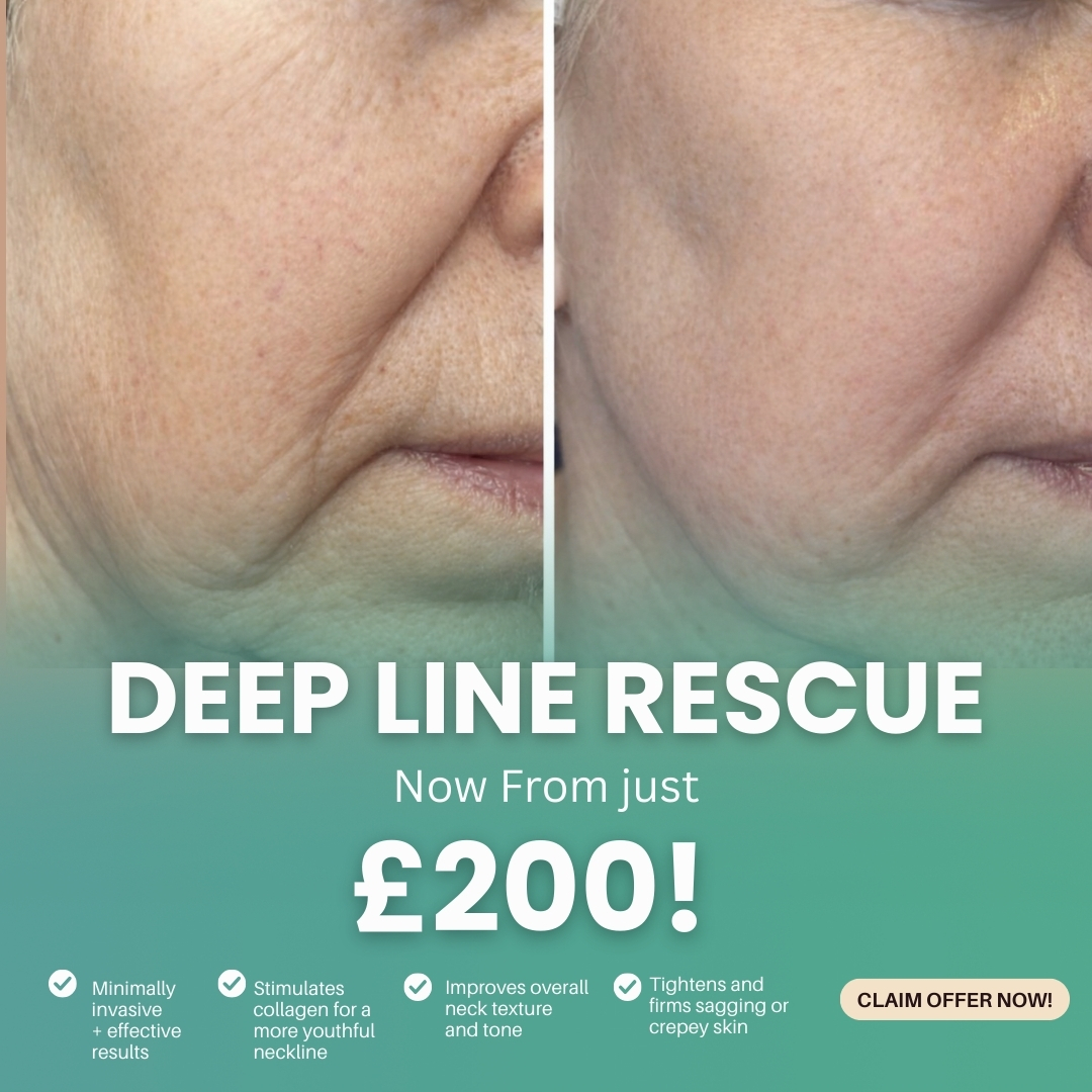 TM Aesthetics Facebook ad: London Skin Rejuvenation, Up To 50% Off CO2 Laser at TM…