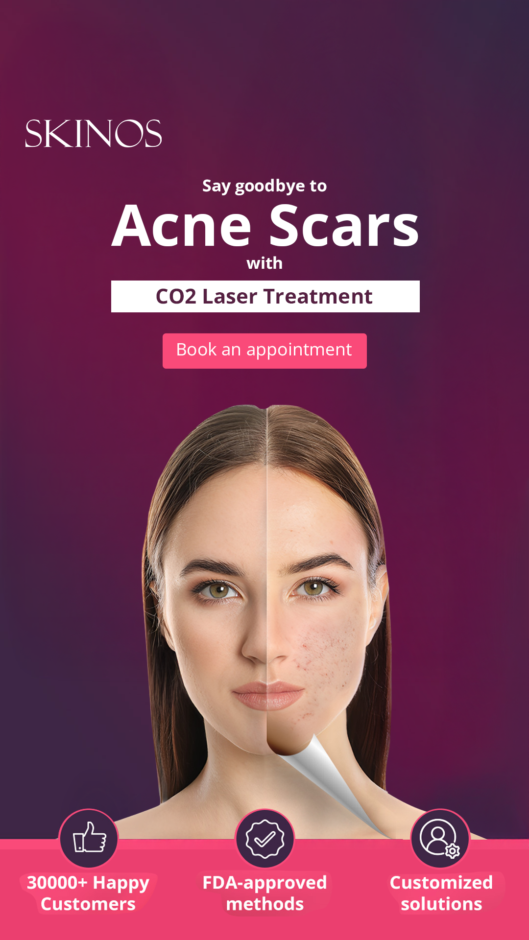 SKINOS Facebook ad