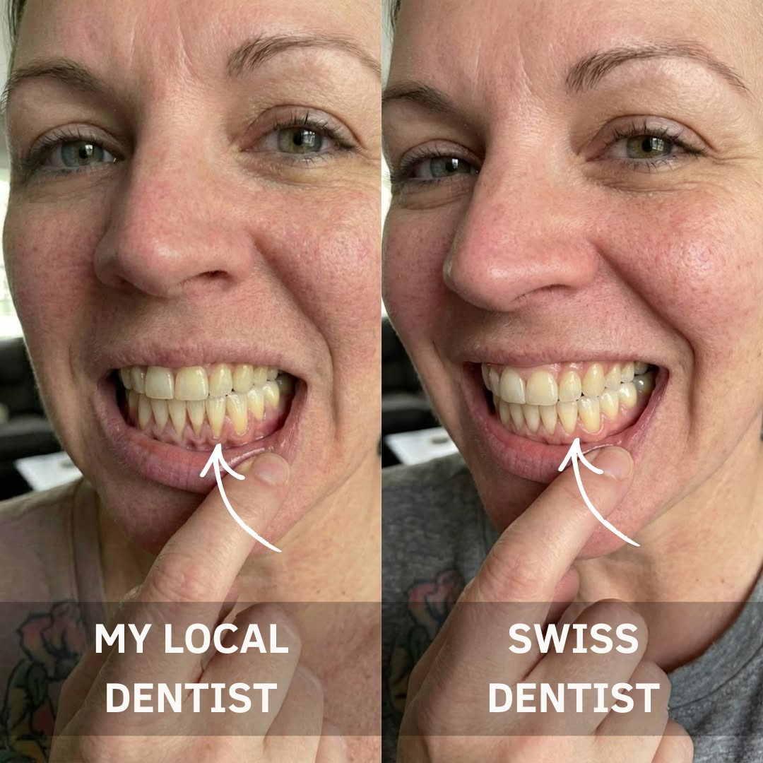Oral Health Central Facebook ad: Before You Schedule That Gum Graft Surgery, Read This.